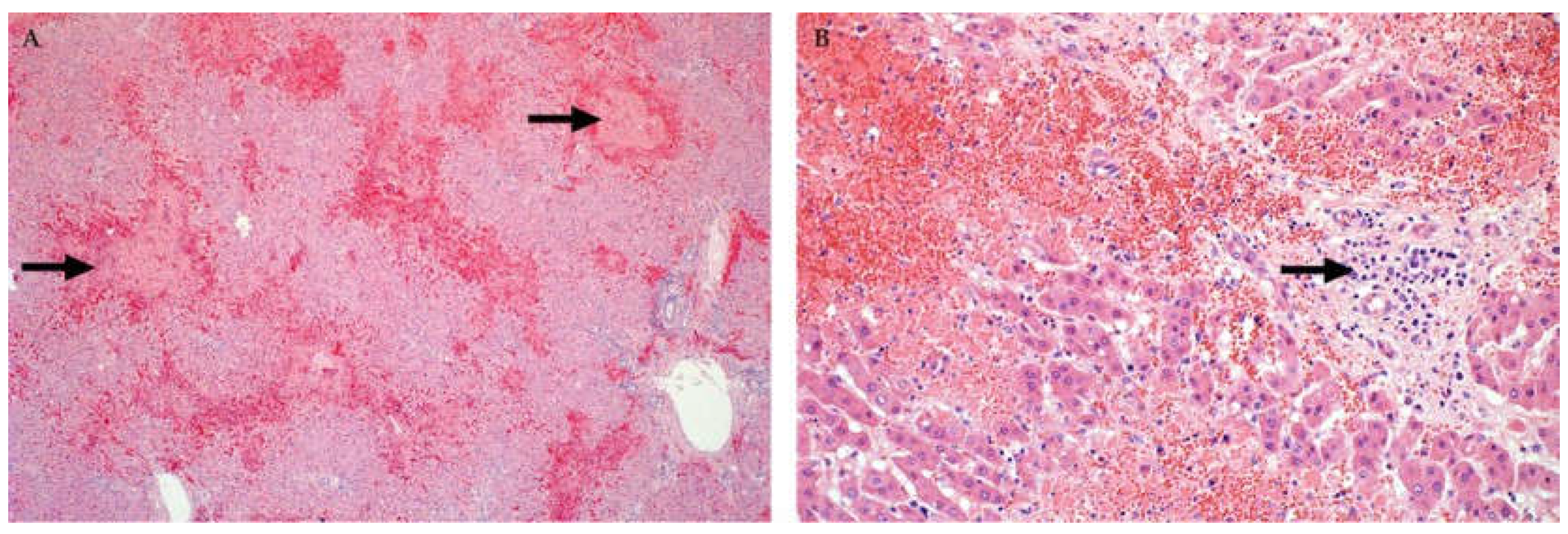 Viruses 13 00709 g002 Viruses 13 00709 g002