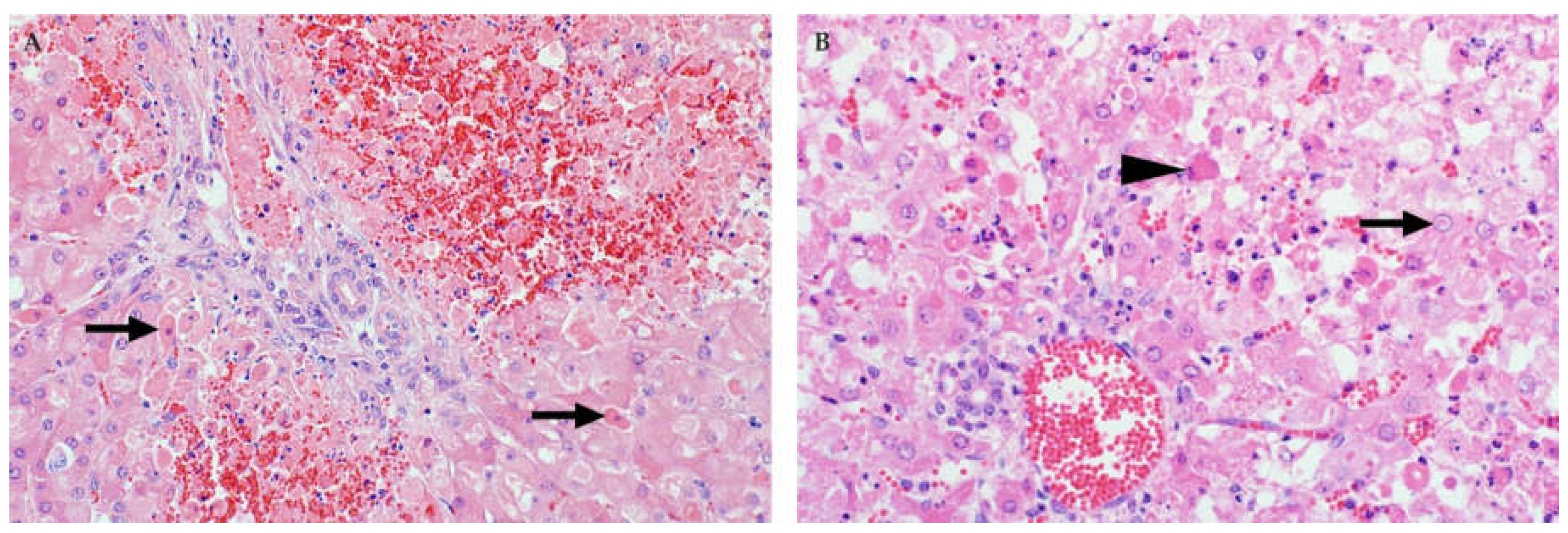 Viruses 13 00709 g003 Viruses 13 00709 g003