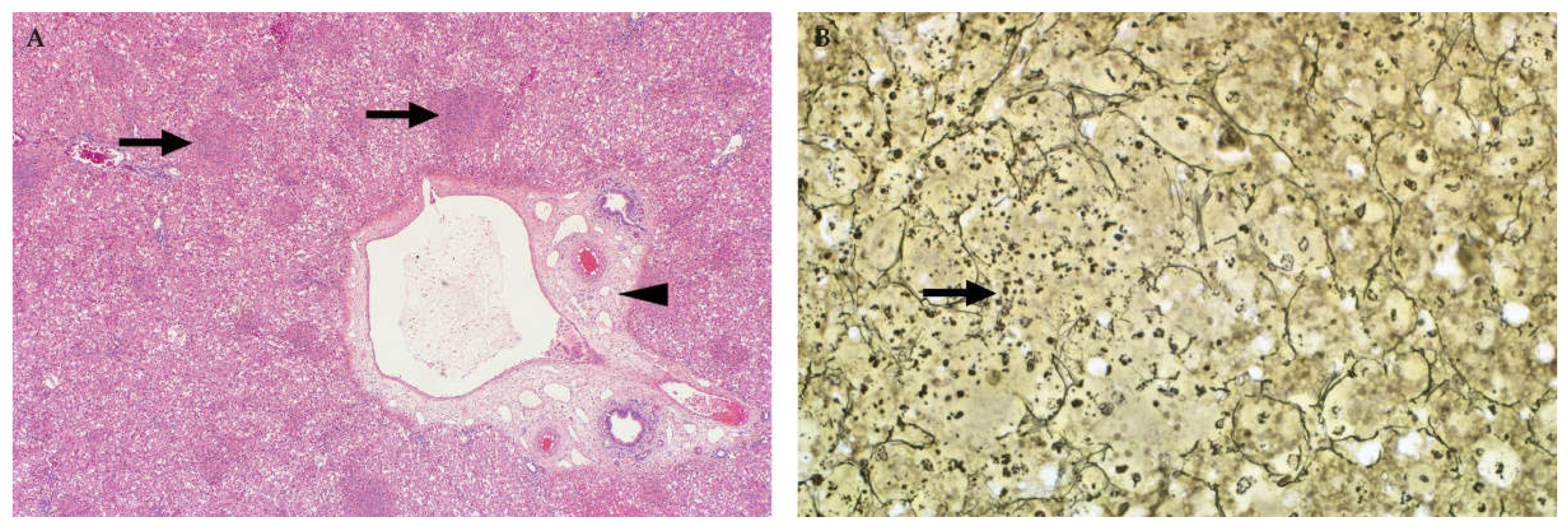 Viruses 13 00709 g004 Viruses 13 00709 g004