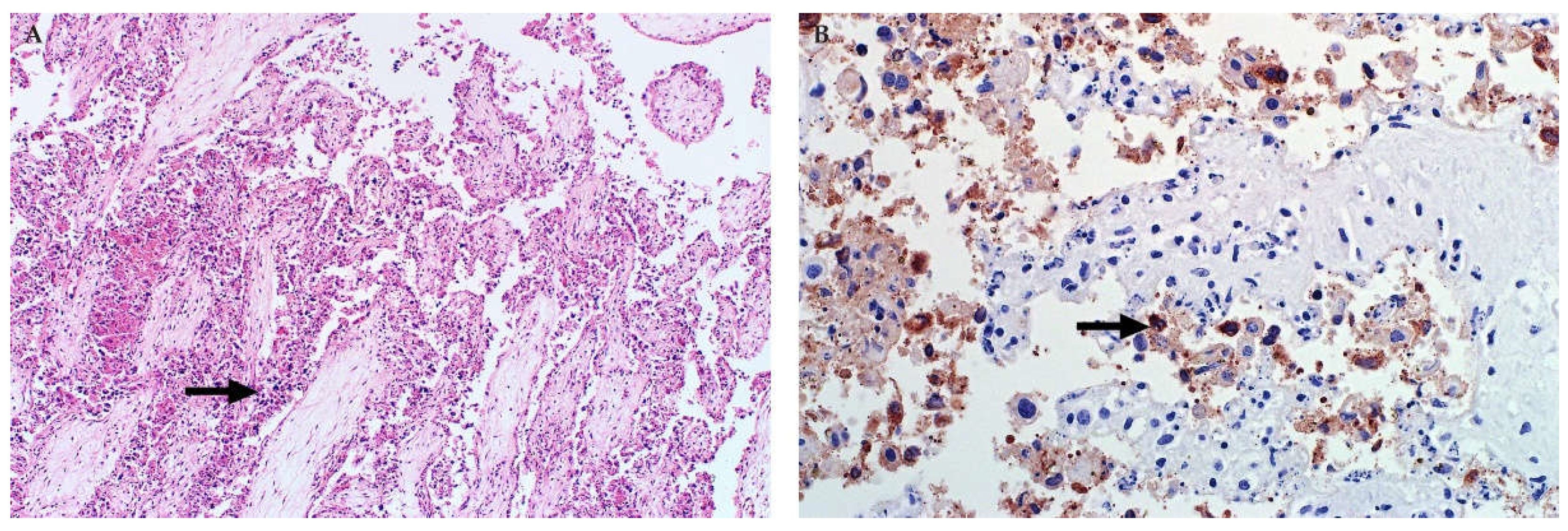 Viruses 13 00709 g015 Viruses 13 00709 g015