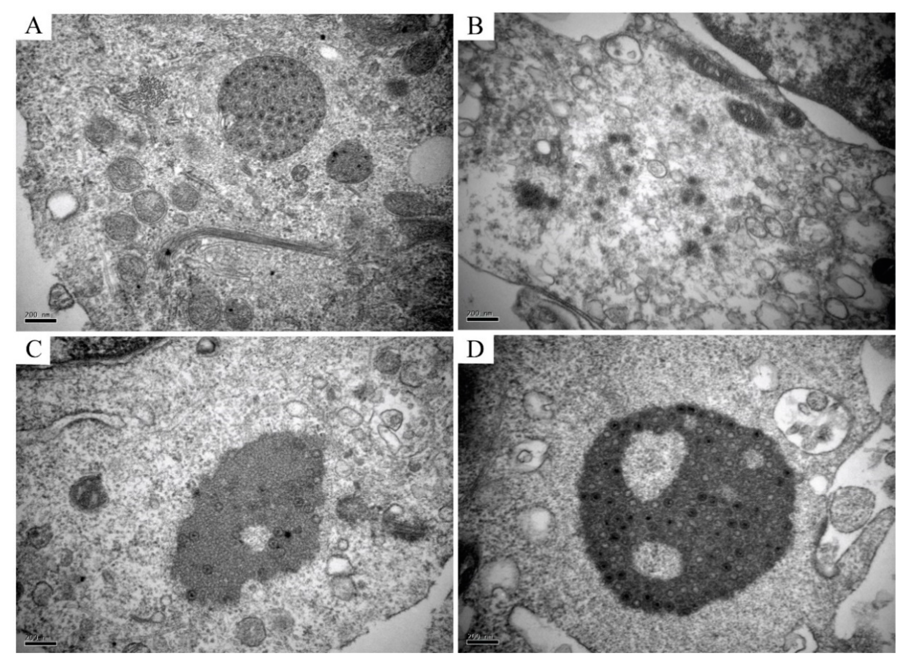 Viruses 13 00870 g004 Viruses 13 00870 g004