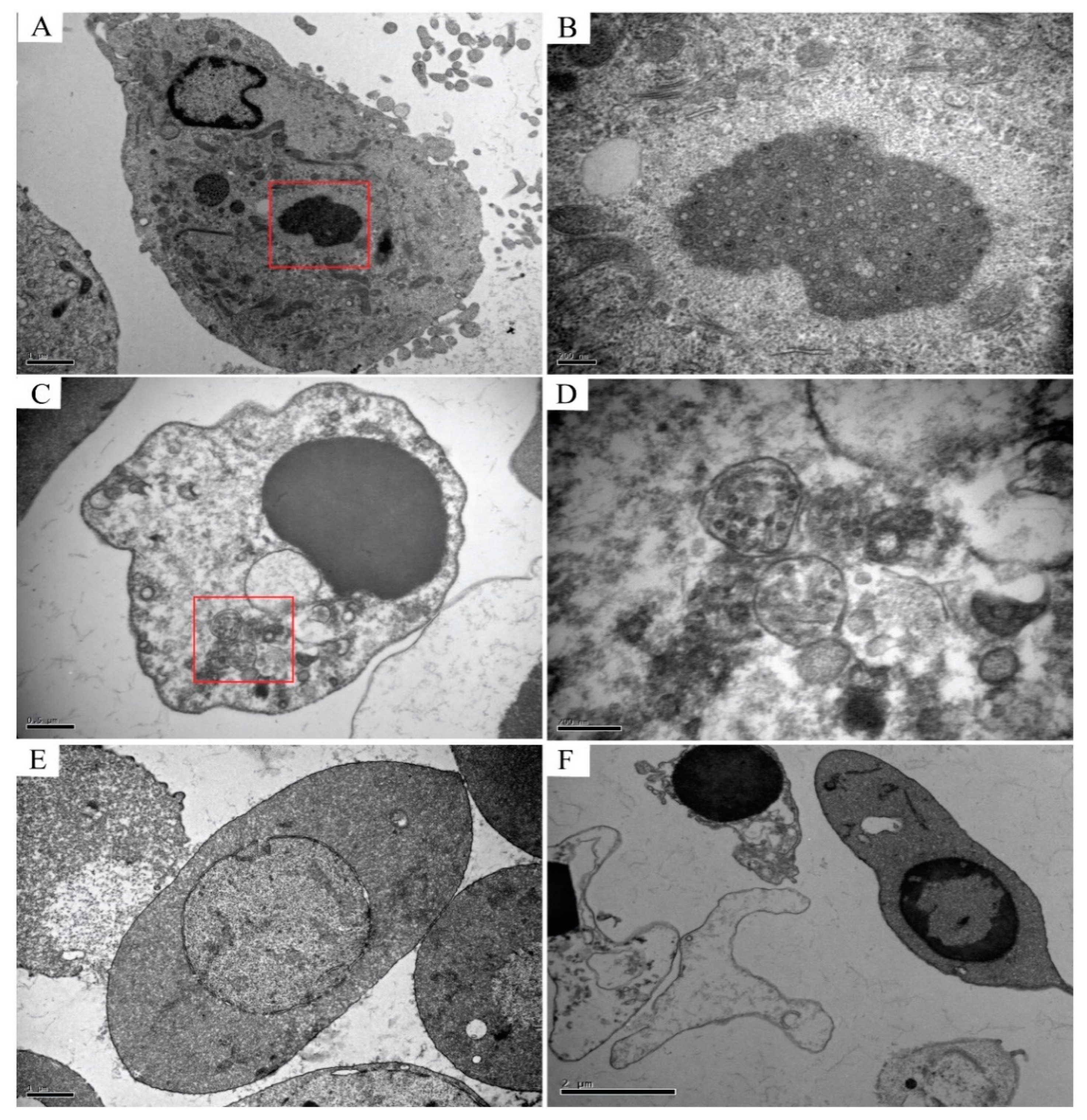 Viruses 13 00870 g005 Viruses 13 00870 g005