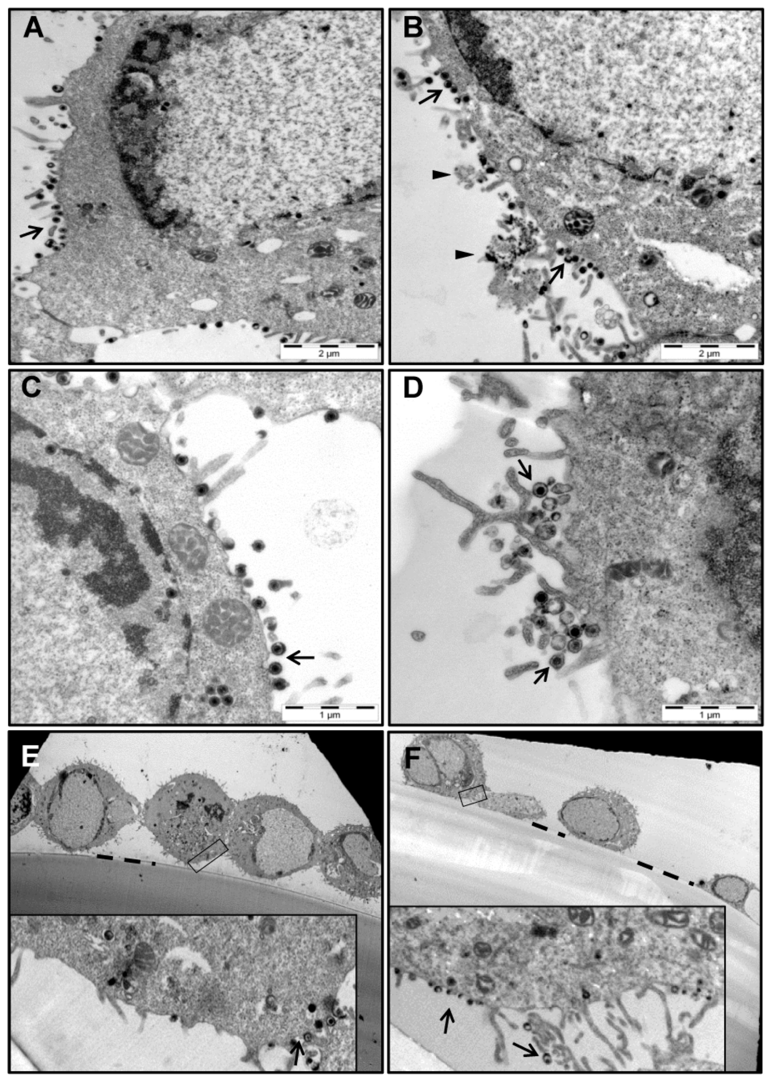 Viruses 13 00887 g002 Viruses 13 00887 g002