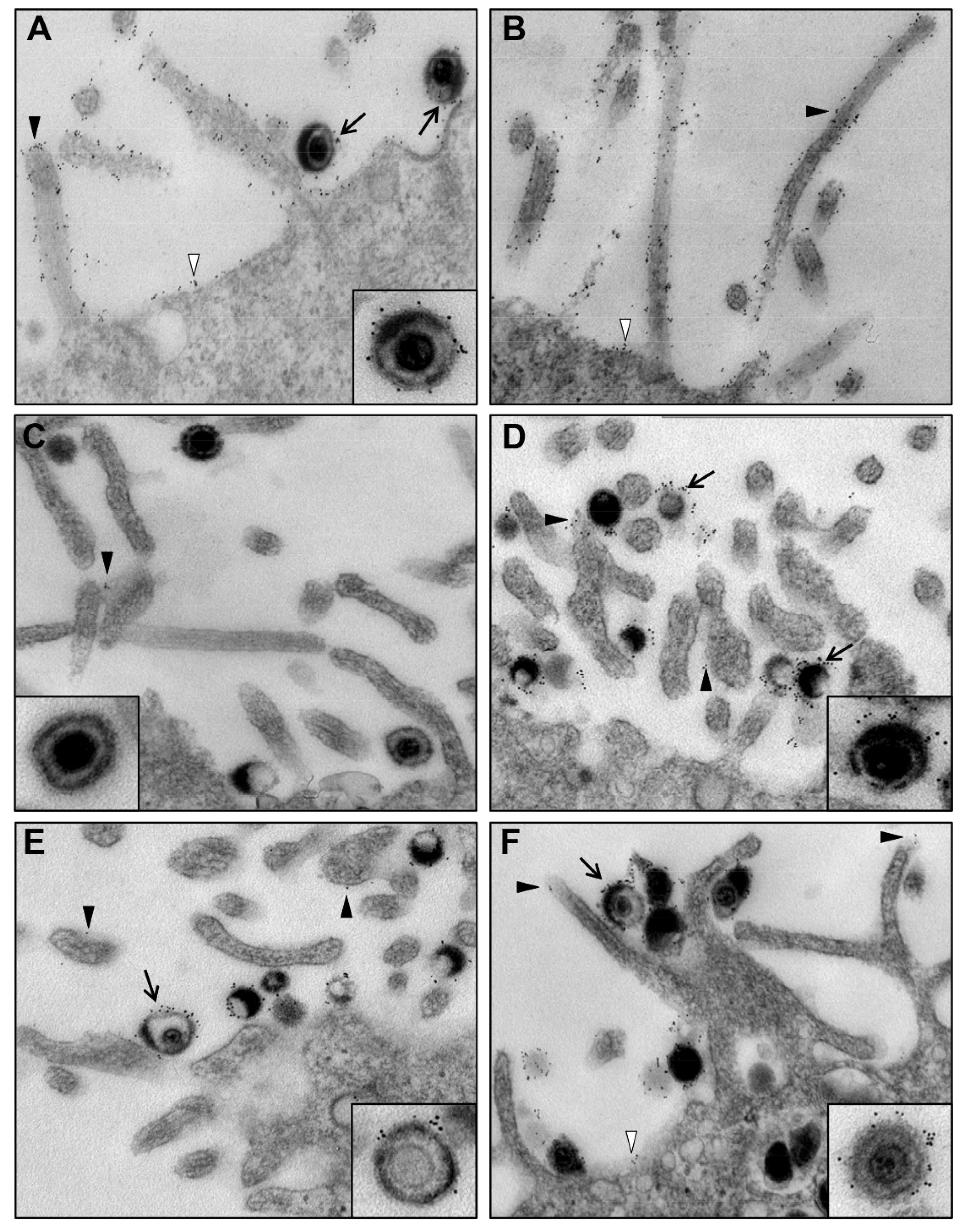 Viruses 13 00887 g003 Viruses 13 00887 g003