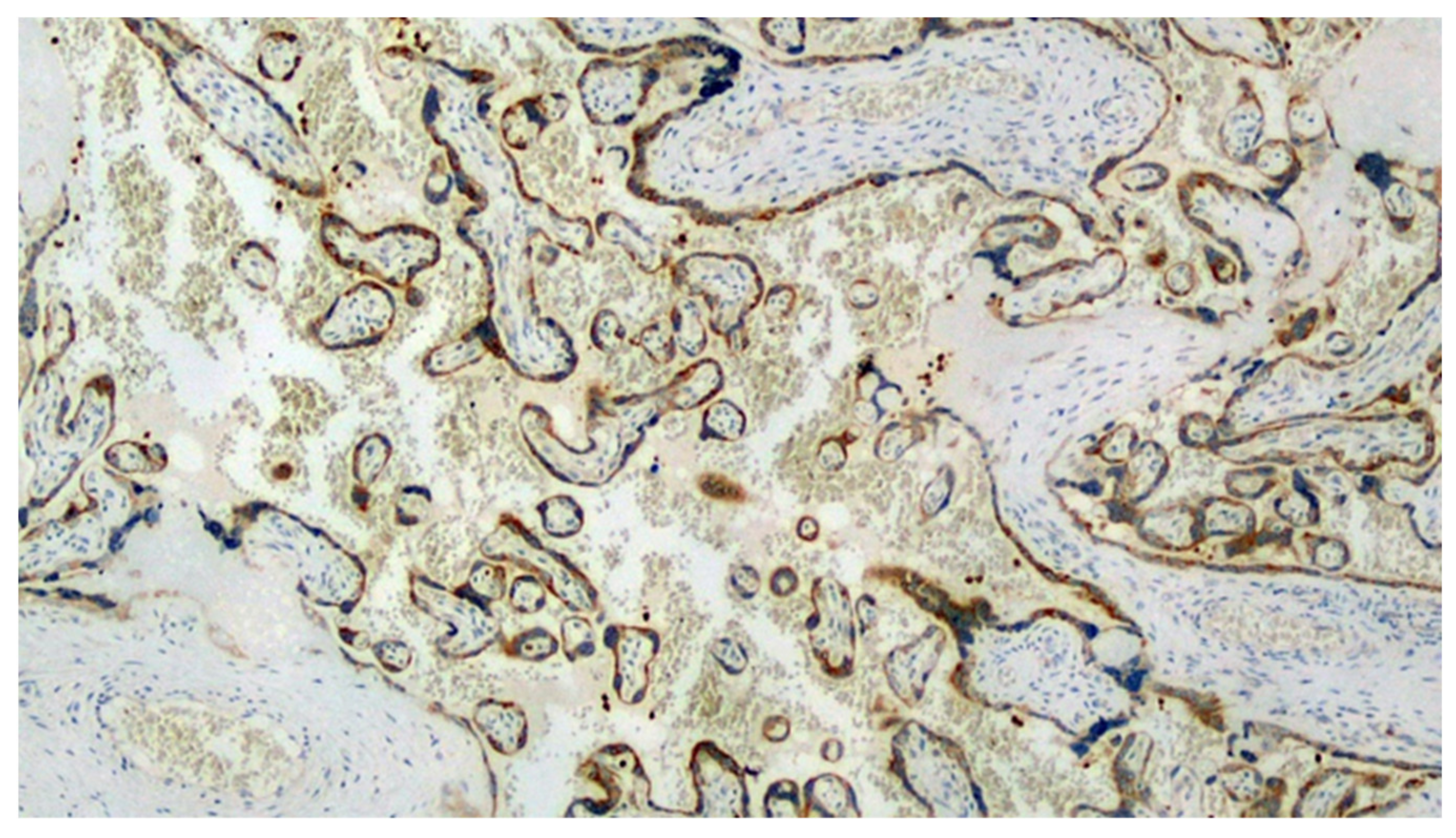 Viruses 13 00995 g002