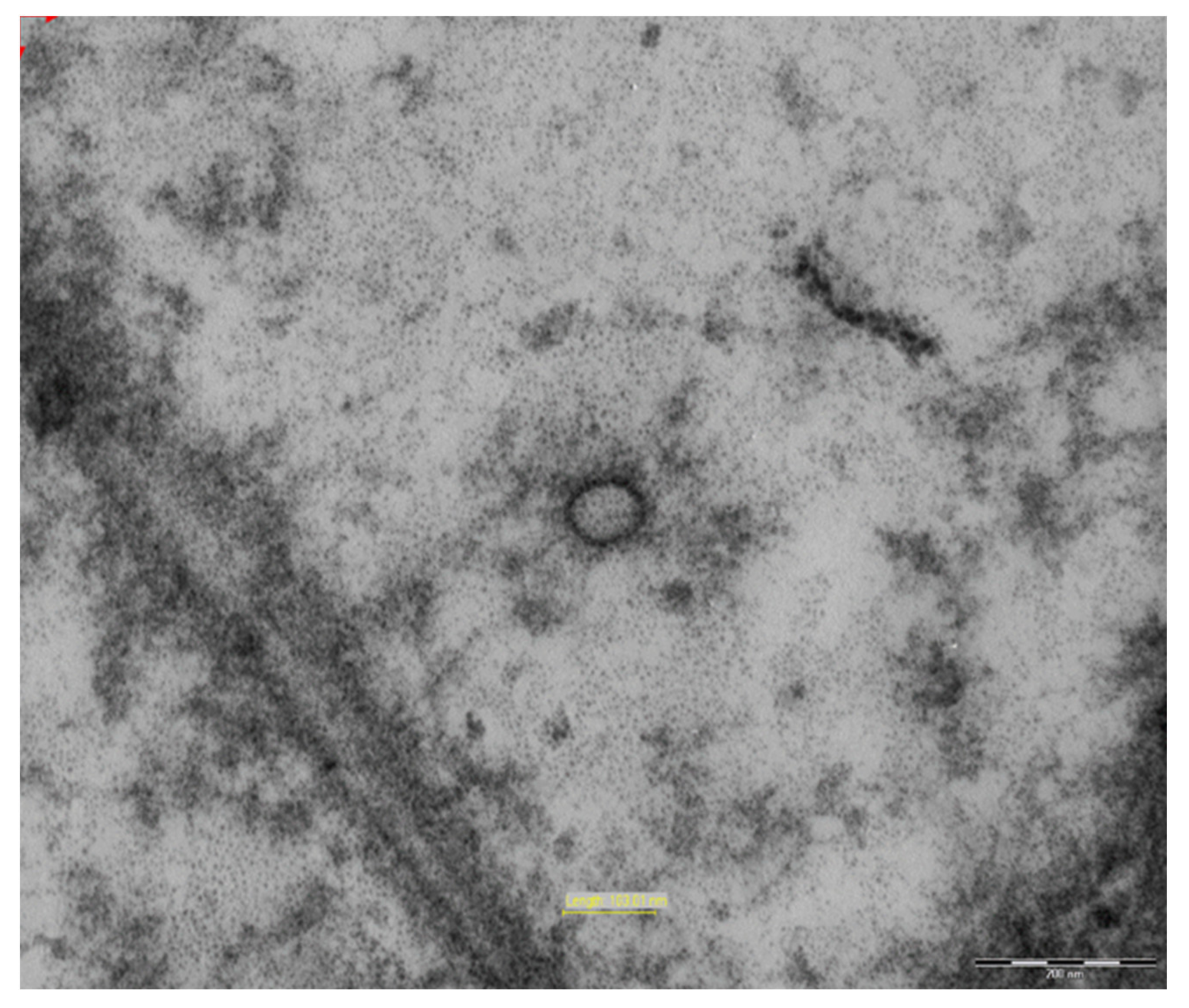 Viruses 13 00995 g003