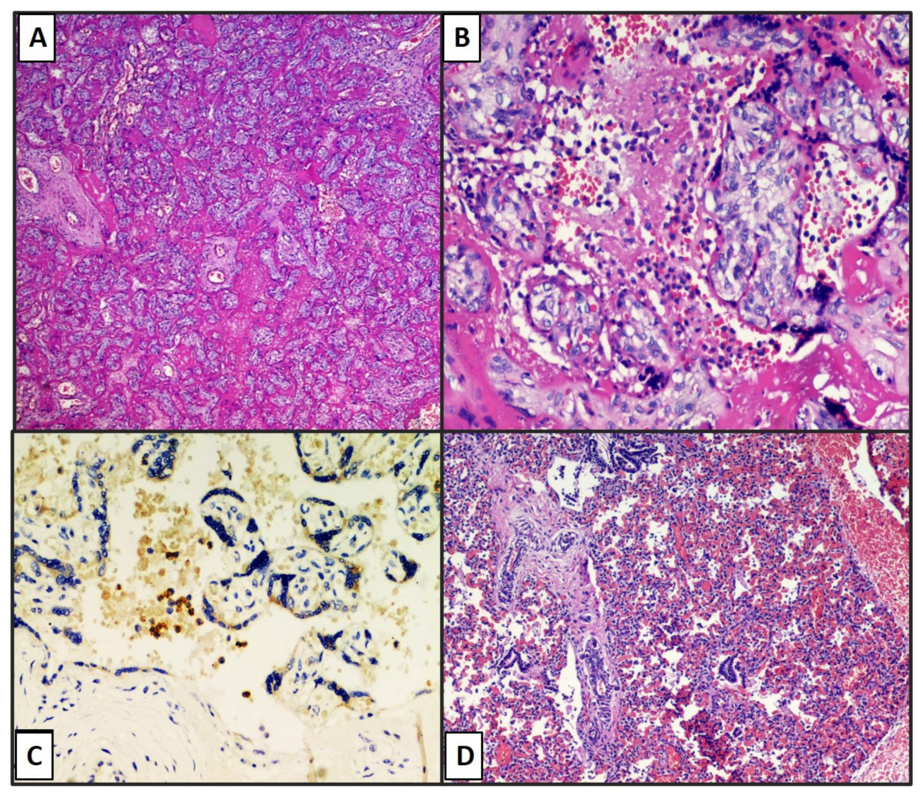 Viruses 13 00995 g004