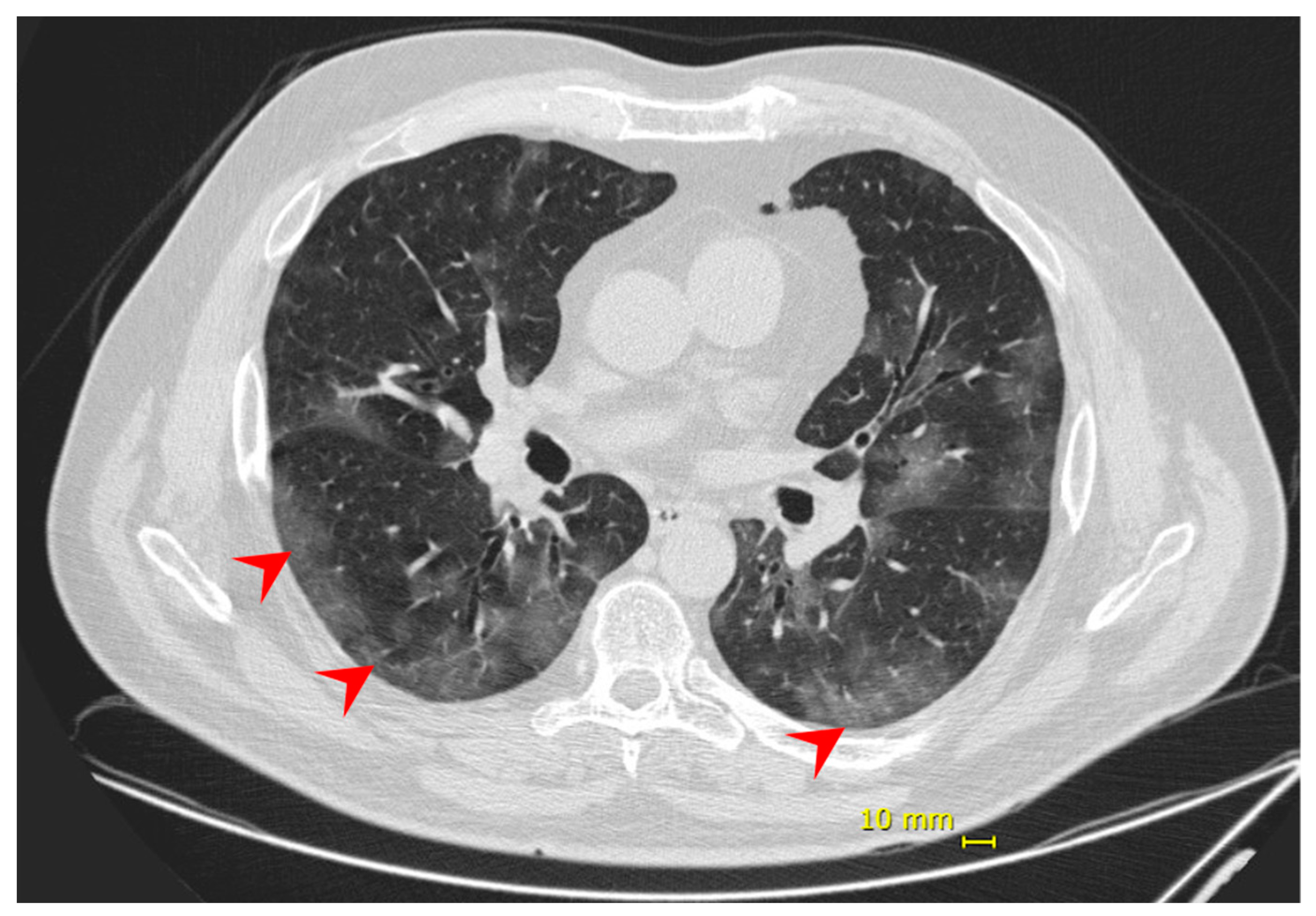 Viruses 13 01237 g001