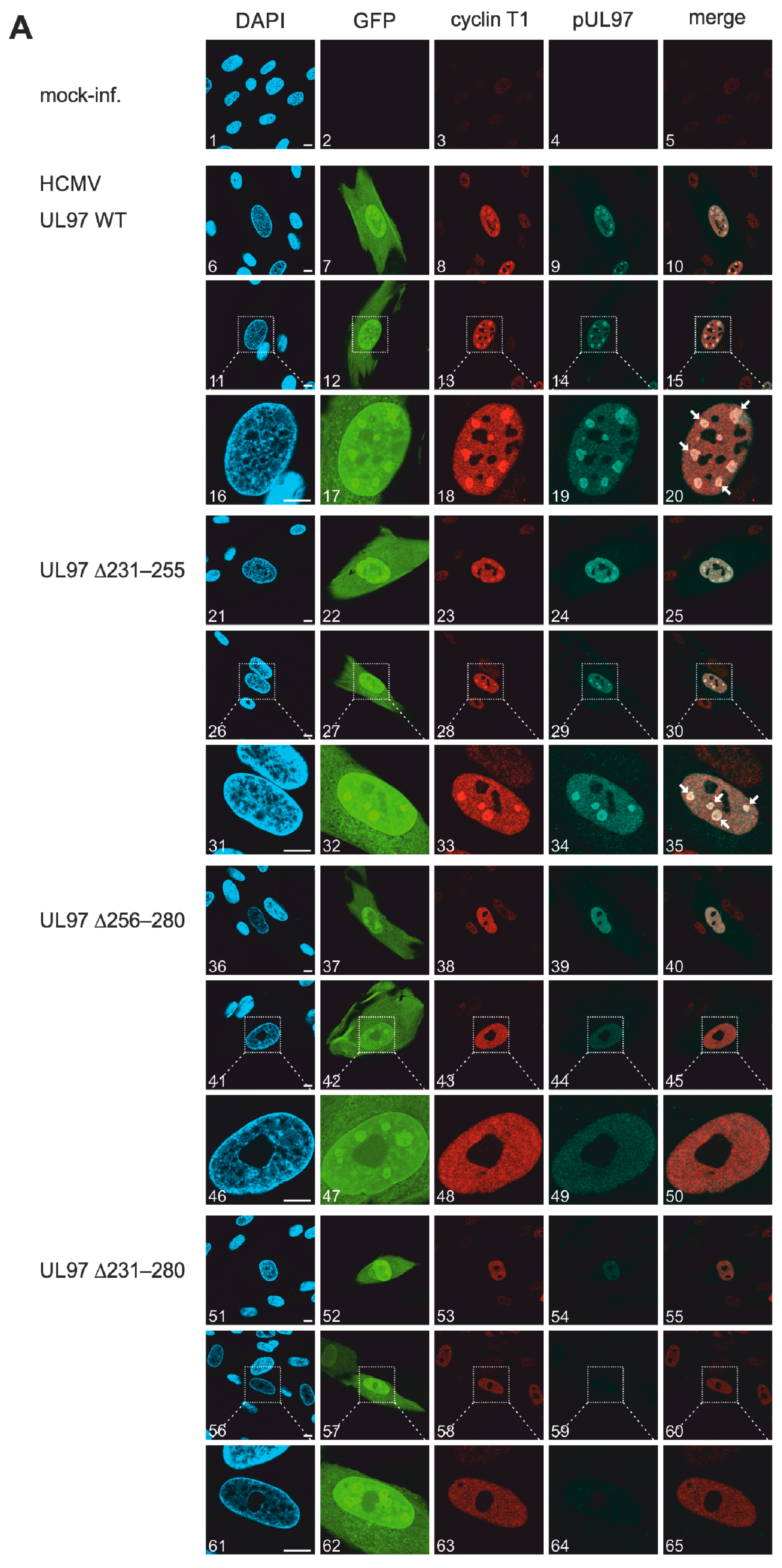 Viruses 13 01248 g005a Viruses 13 01248 g005a