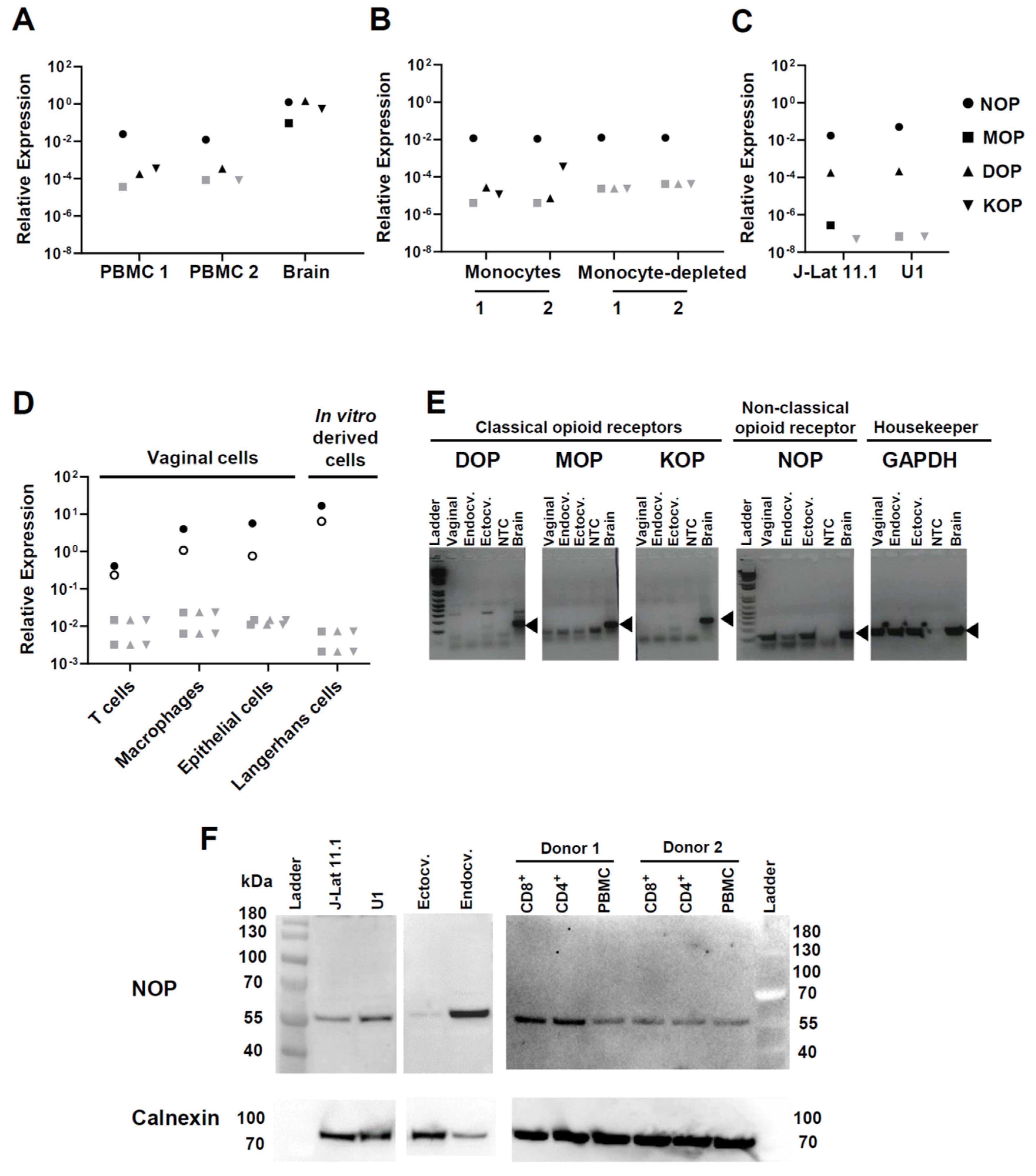 precedent vervormen een vergoeding Viruses | Free Full-Text | Buprenorphine Increases HIV-1 Infection In Vitro but Does Not Reactivate HIV-1 from Latency precedent vervormen een vergoeding Viruses | Free Full-Text | Buprenorphine Increases HIV-1 Infection In Vitro but Does Not Reactivate HIV-1 from Latency
