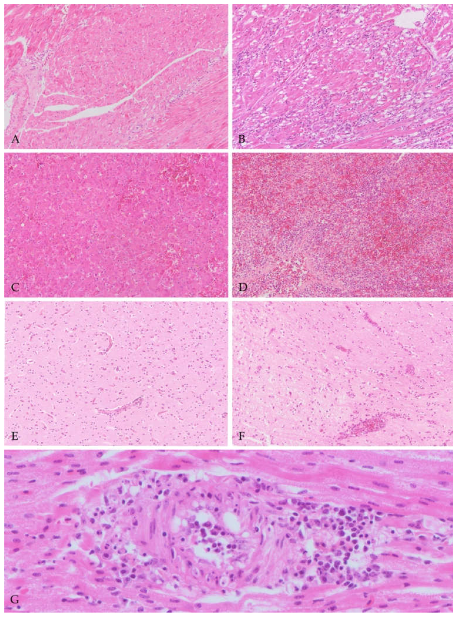 Viruses 13 01481 g001