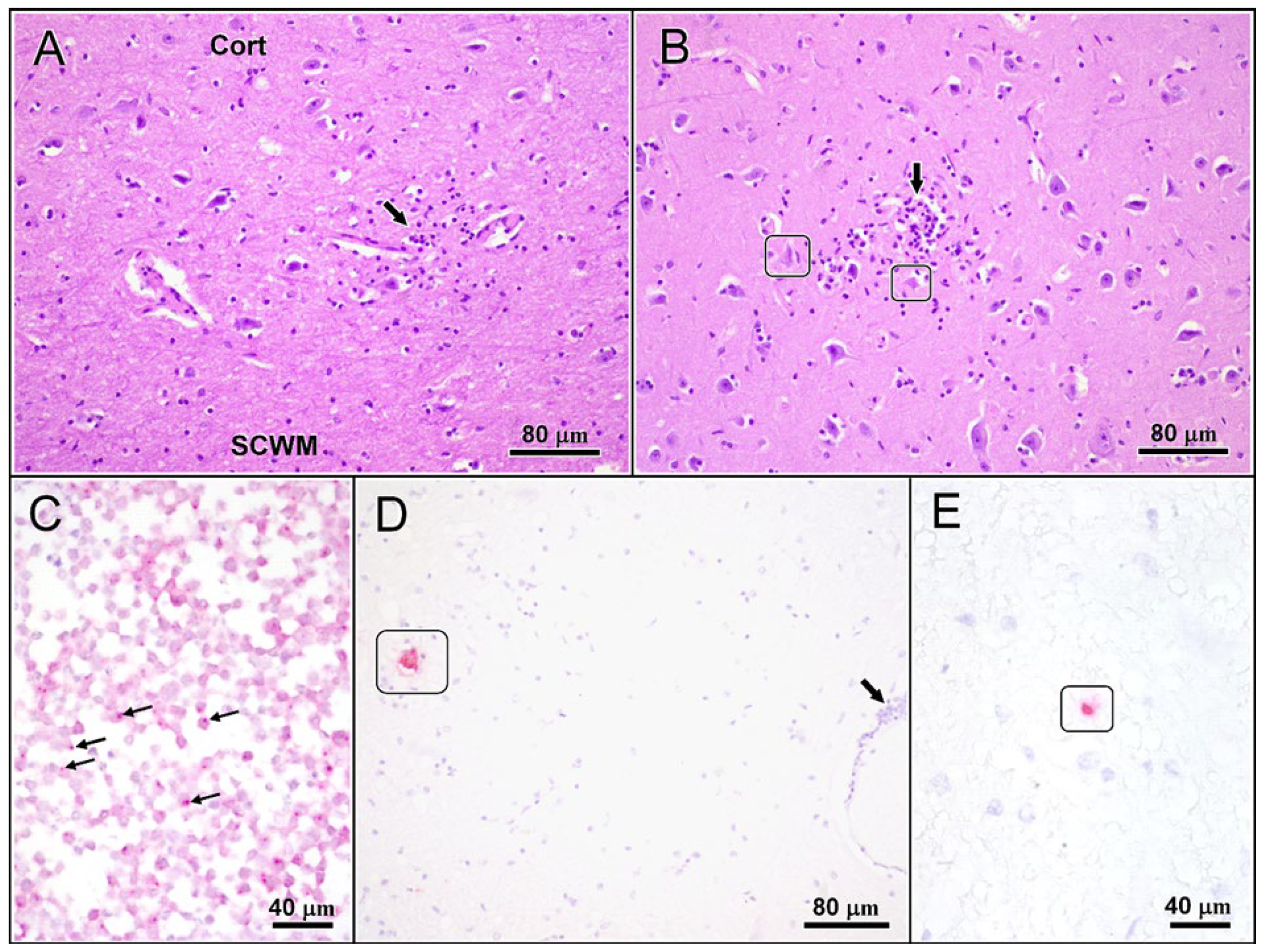 Viruses | Free Full-Text | Tick-Borne Virus (TBEV) Infection in Two Horses