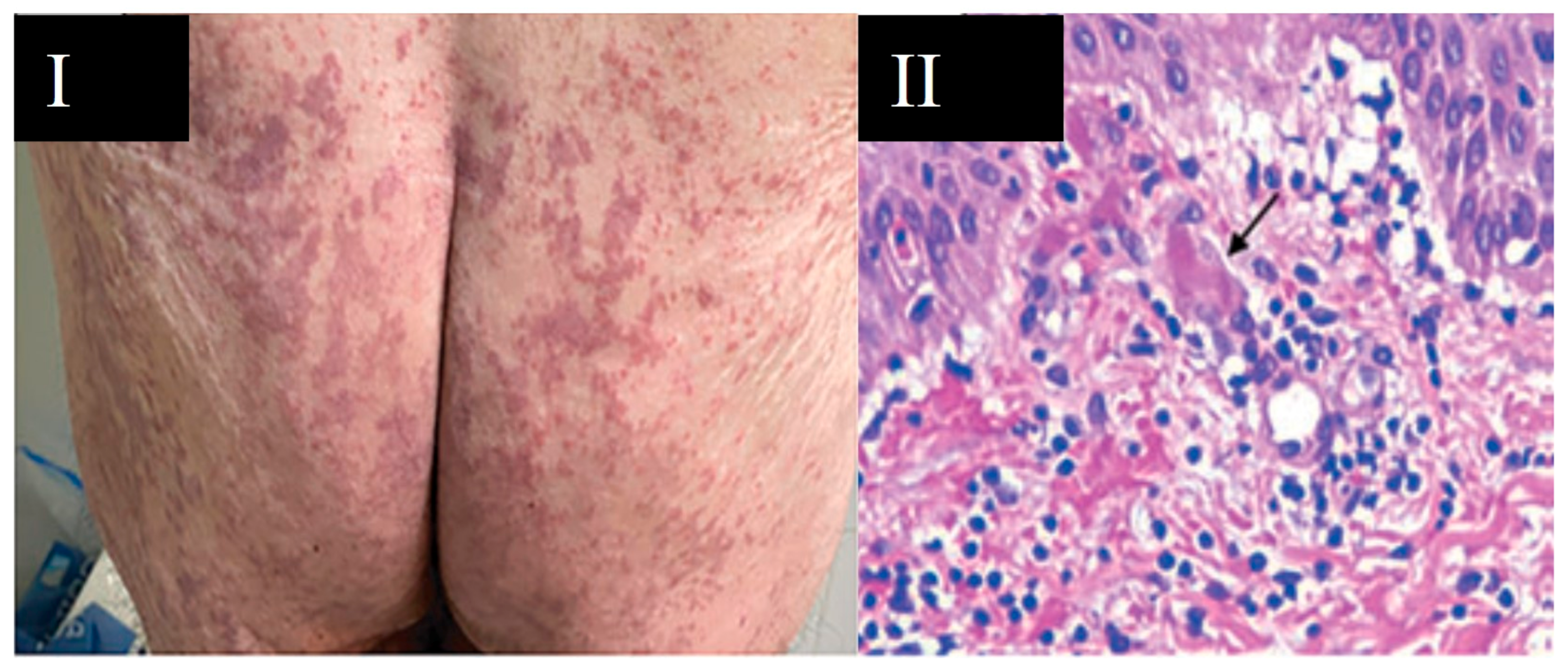 Viruses 13 01916 g006