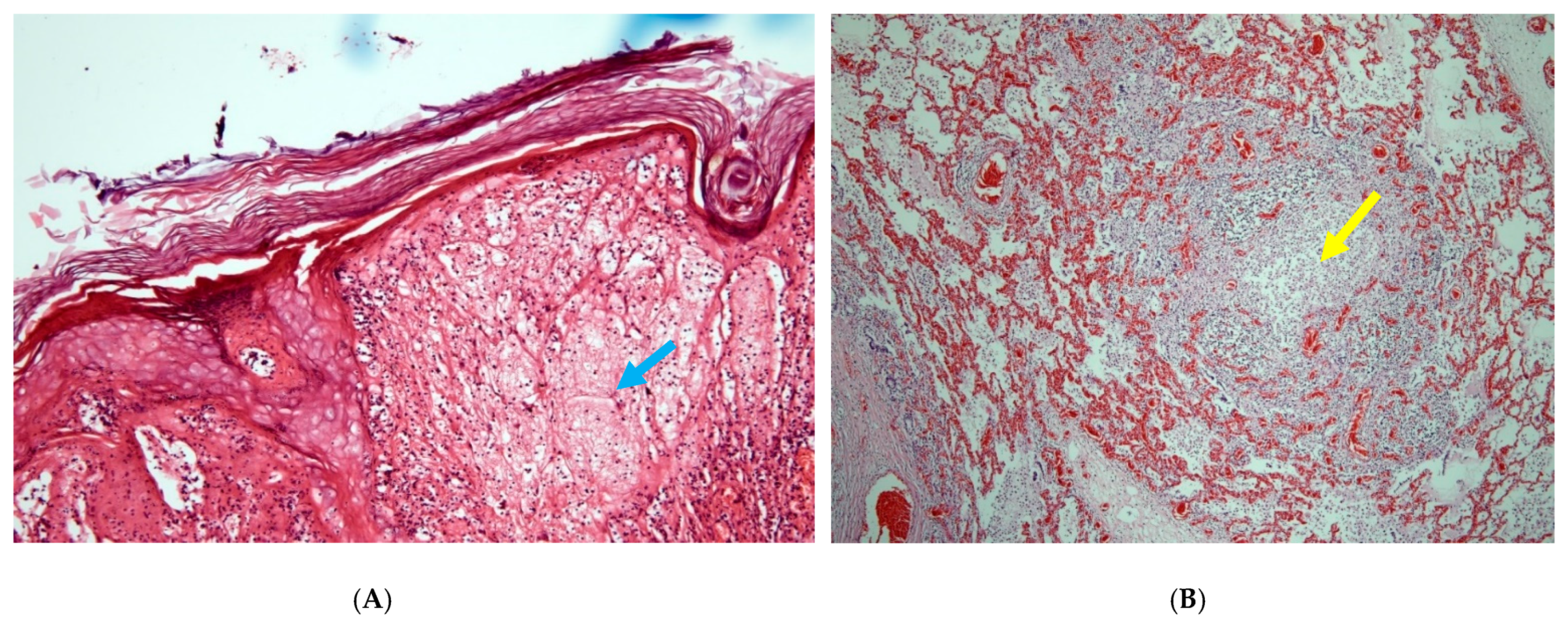 Viruses 13 01940 g002