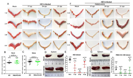 Uterine Injury Caused by Genotype 4 Hepatitis E Virus
