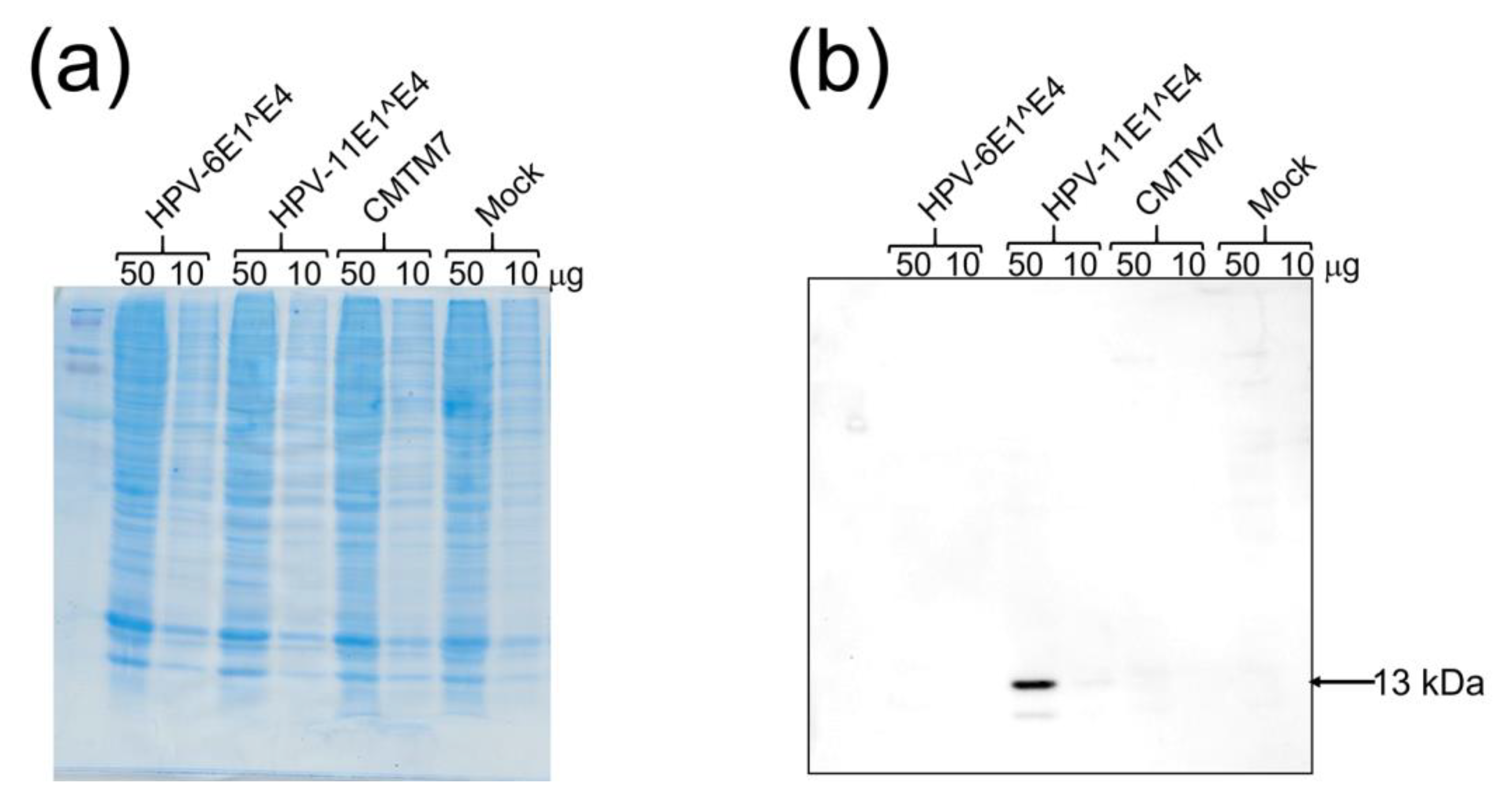 anti papilloma 4v