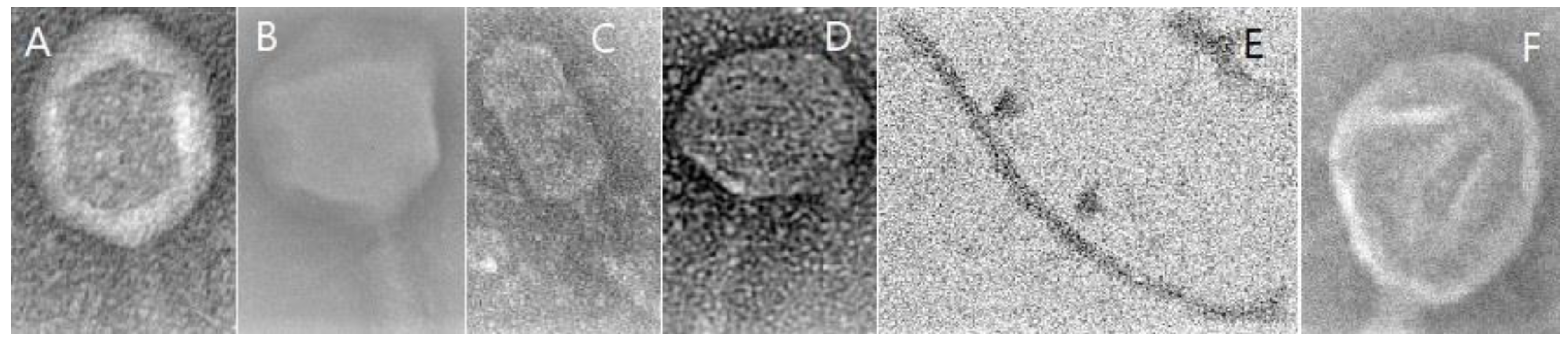 Viruses 13 02348 g001 Viruses 13 02348 g001