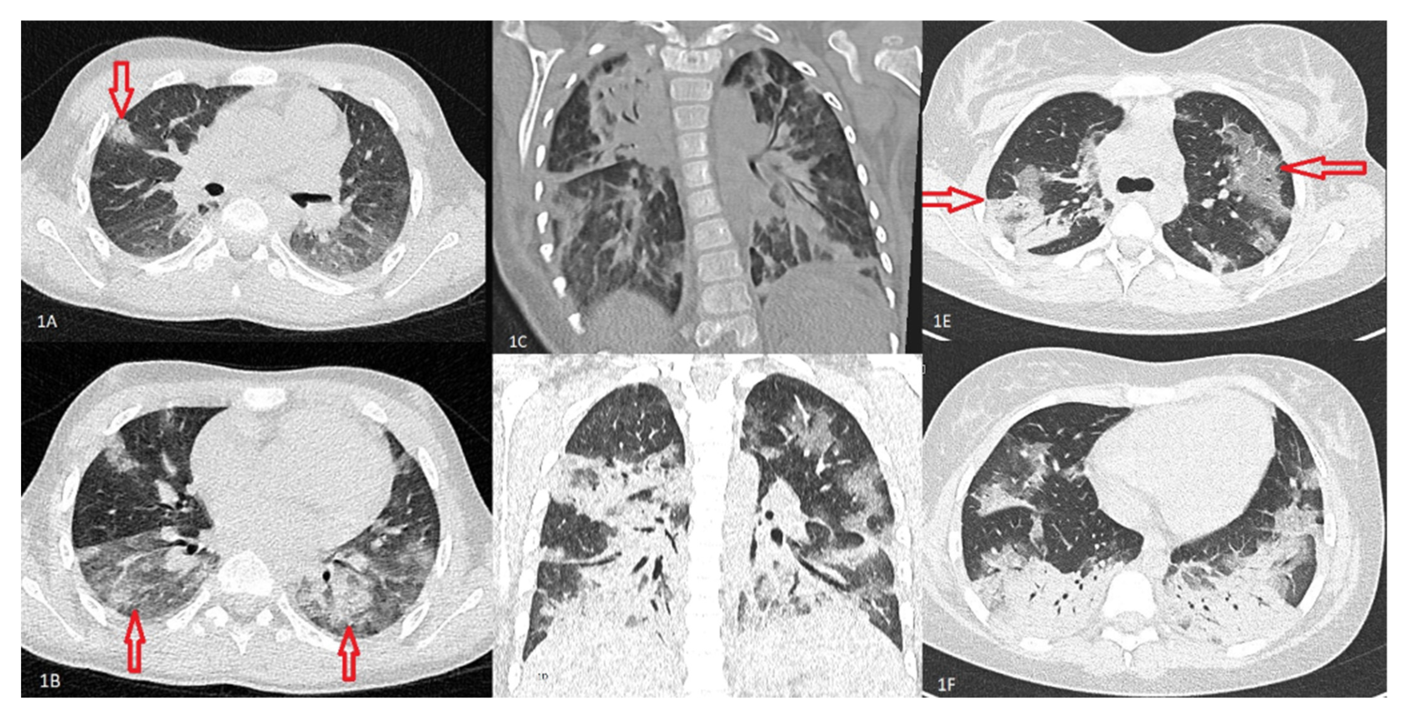 Viruses 13 02366 g001