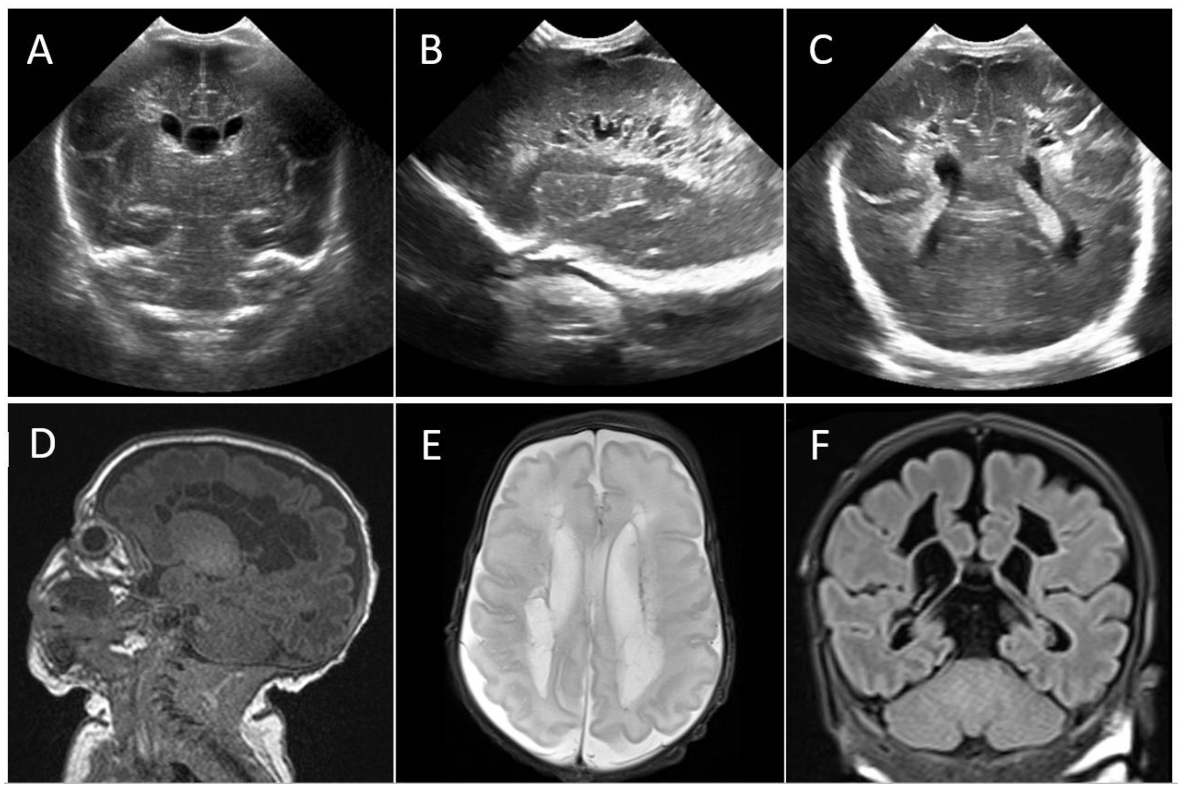 Viruses 13 02517 g002