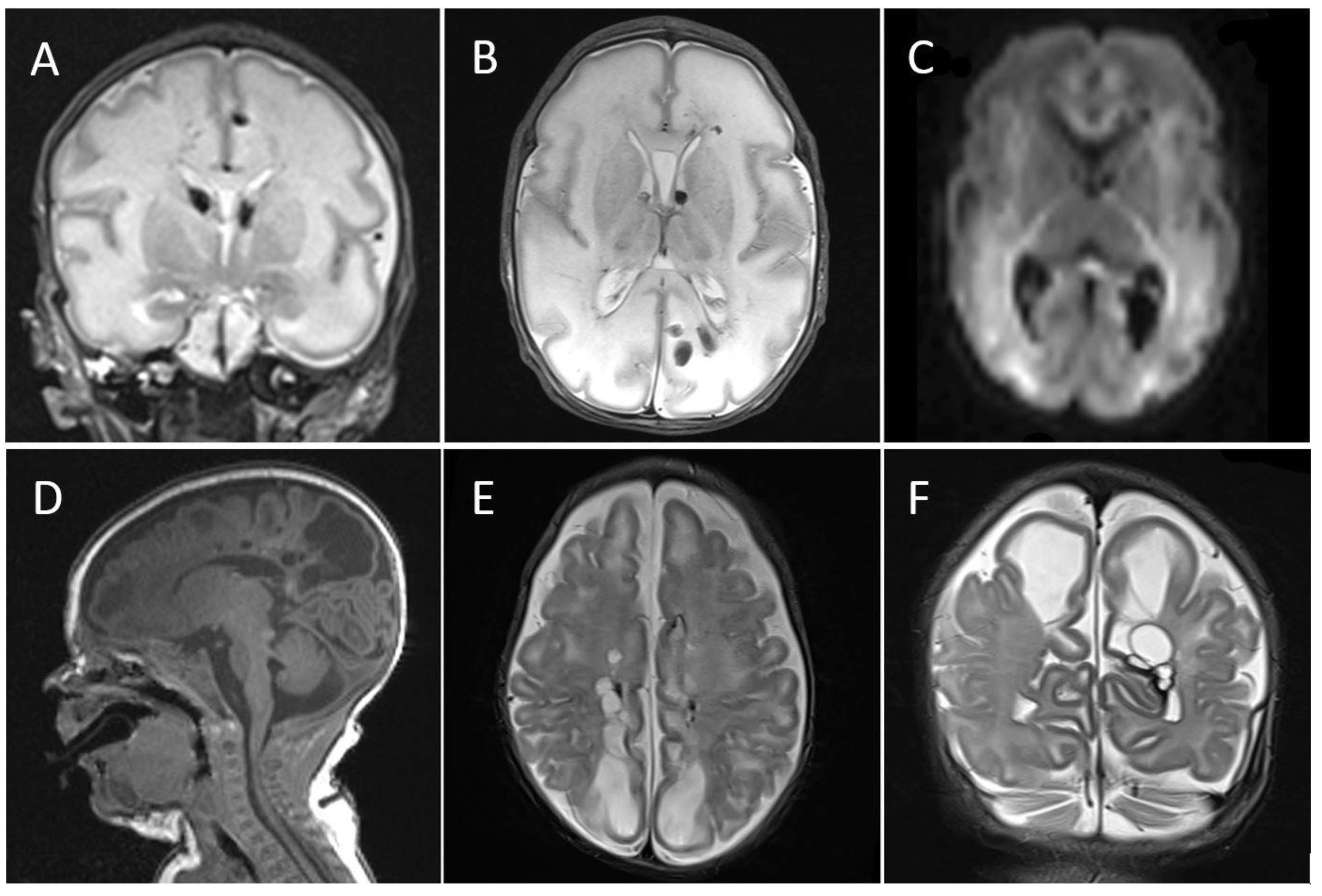 Viruses 13 02517 g003