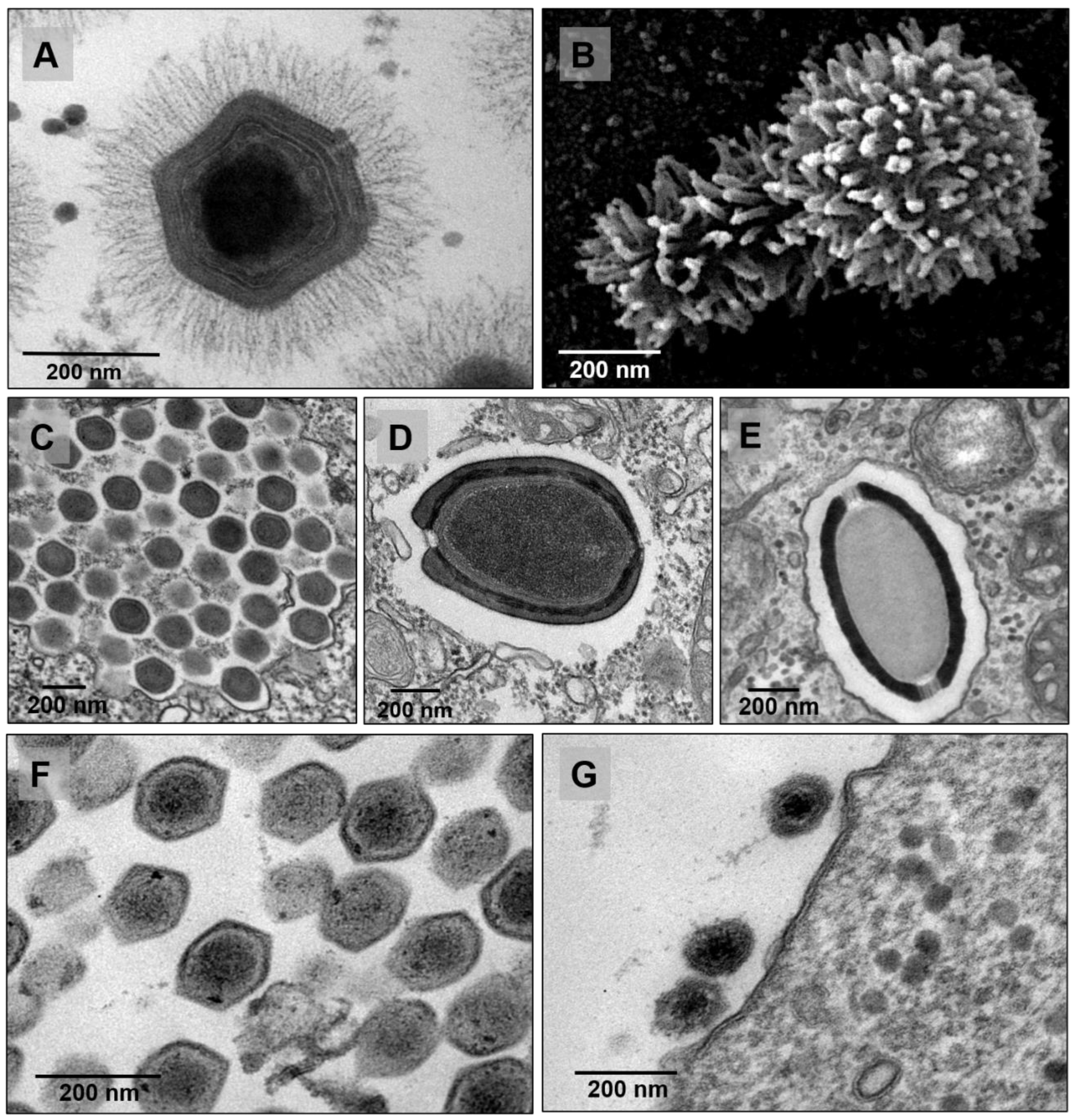 A Brief History of Giant Viruses' Studies in Brazilian Biomes