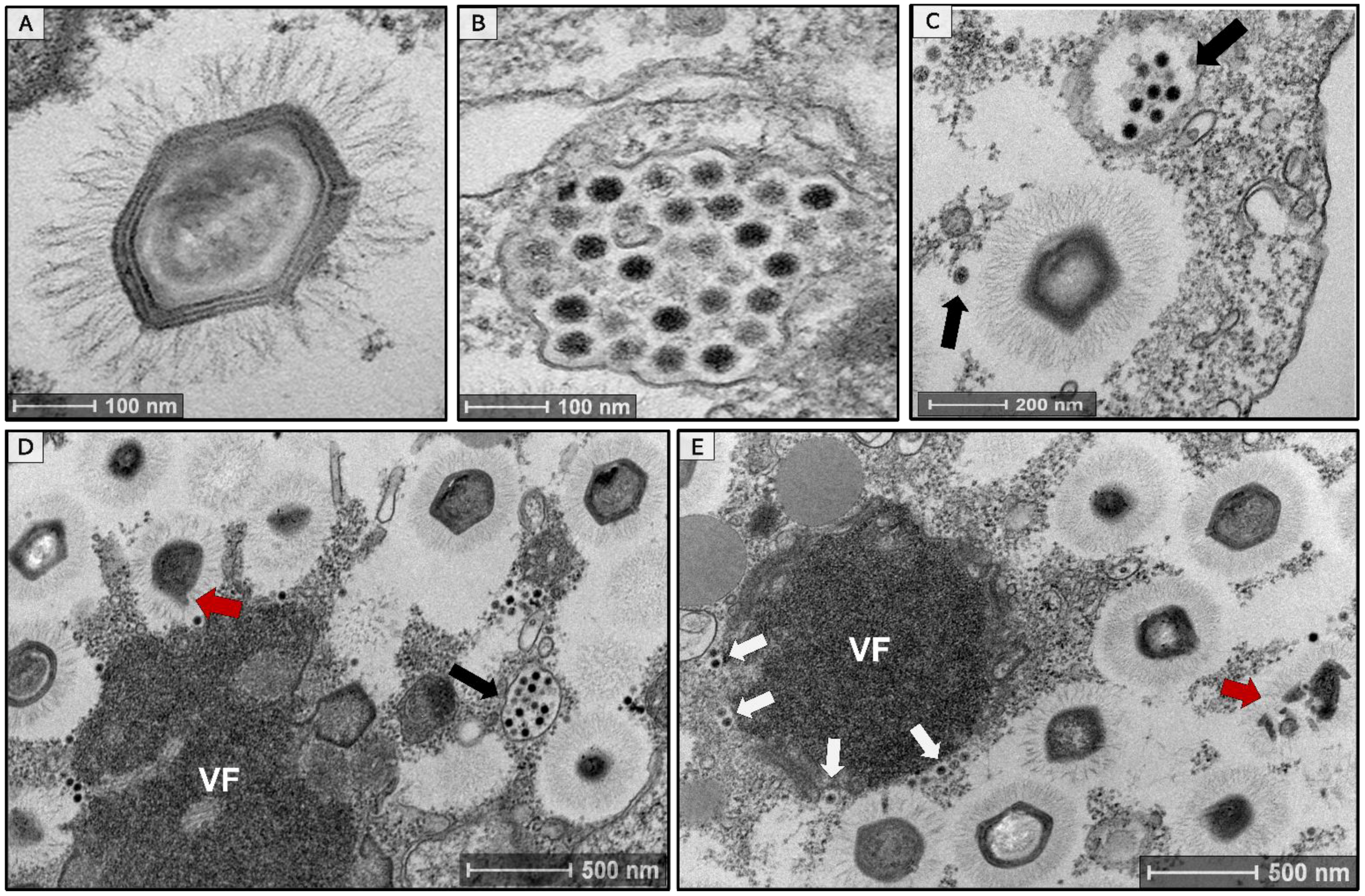 Viruses 14 00206 g001