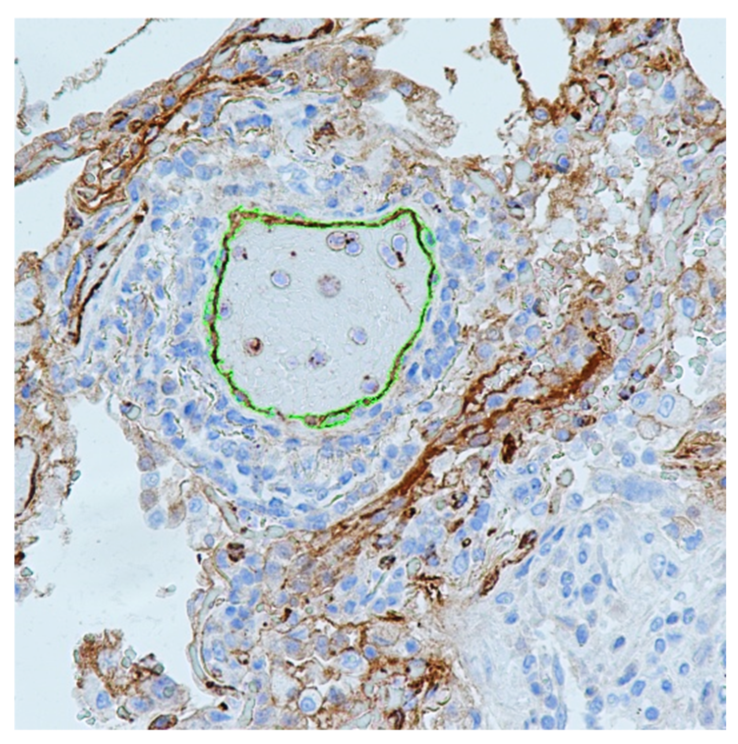 Viruses 14 00211 g001 Viruses 14 00211 g001