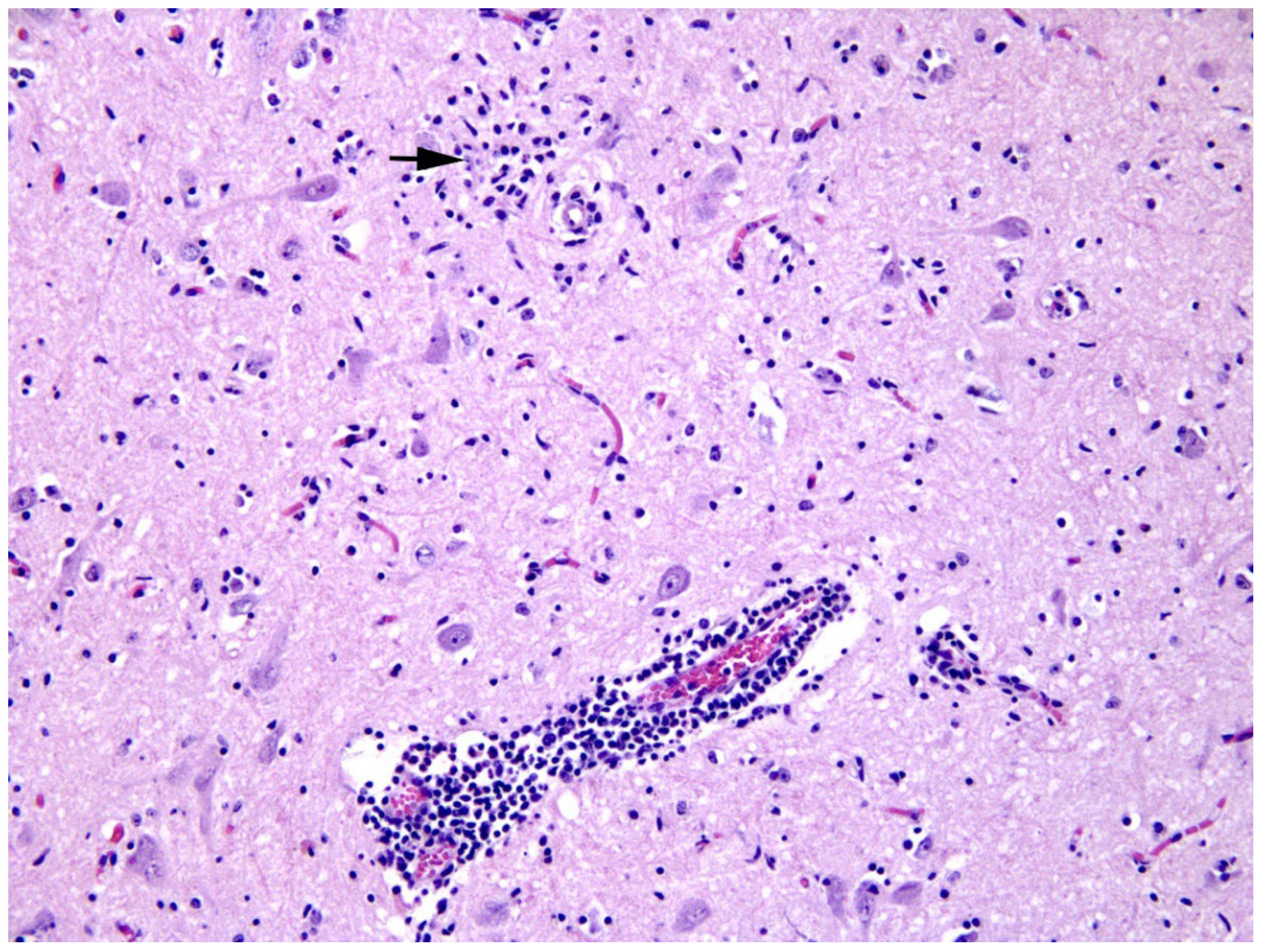 Viruses 14 00300 g002 Viruses 14 00300 g002