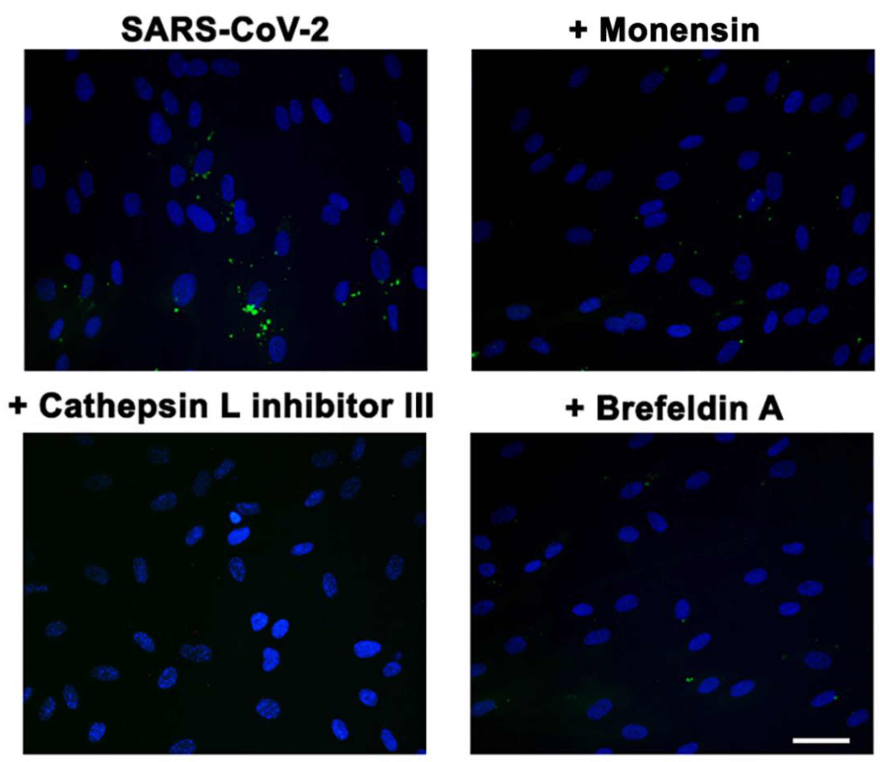 Viruses 14 00705 g006