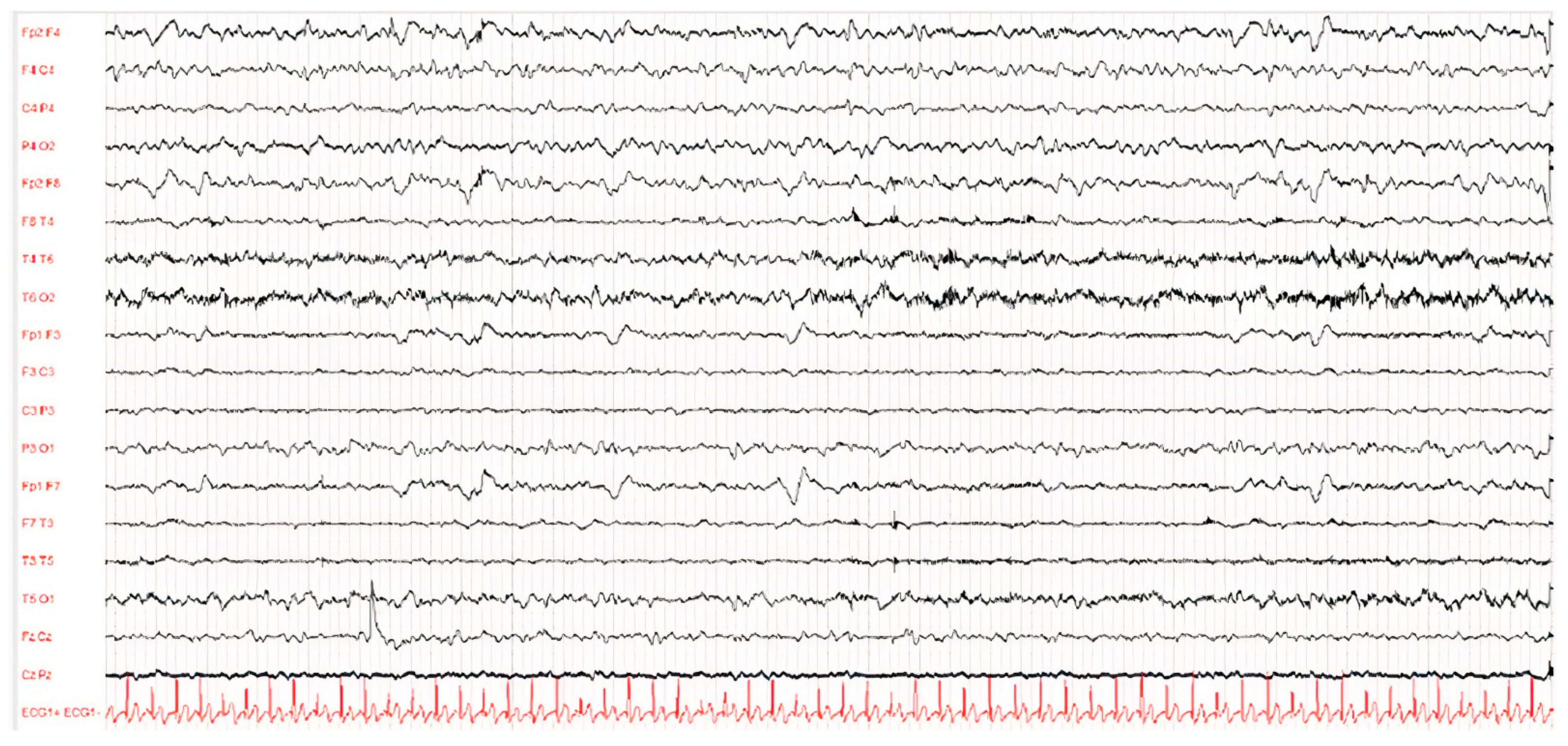 Viruses 14 00733 g002 Viruses 14 00733 g002