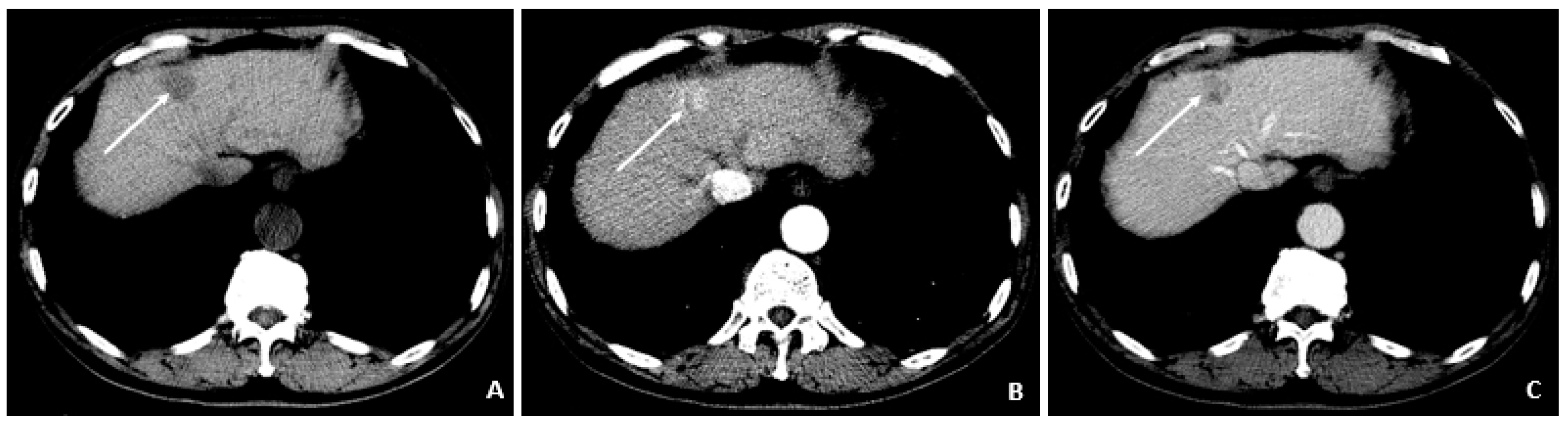 Viruses 14 00775 g005 550