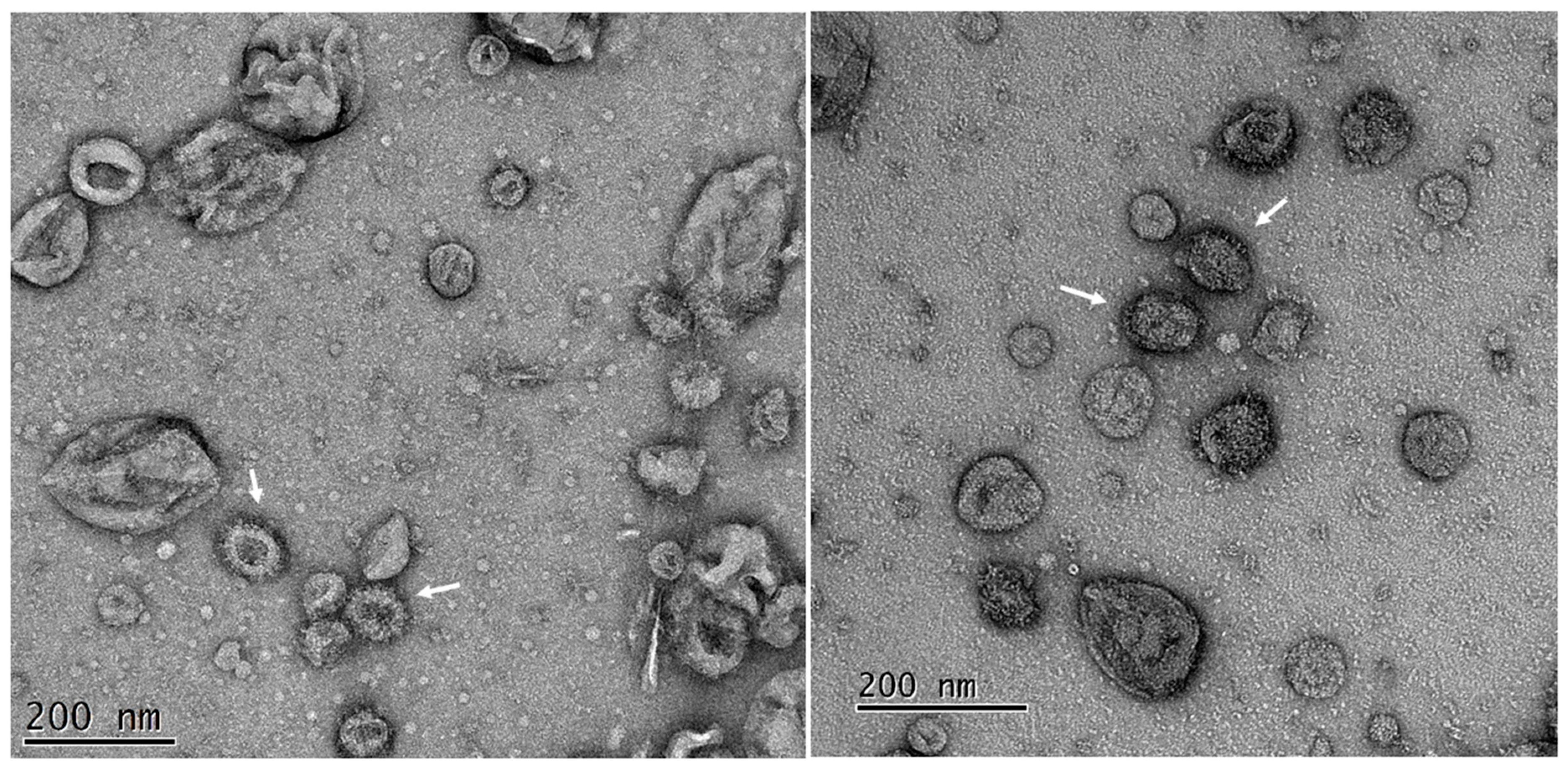 Viruses 14 00914 g004