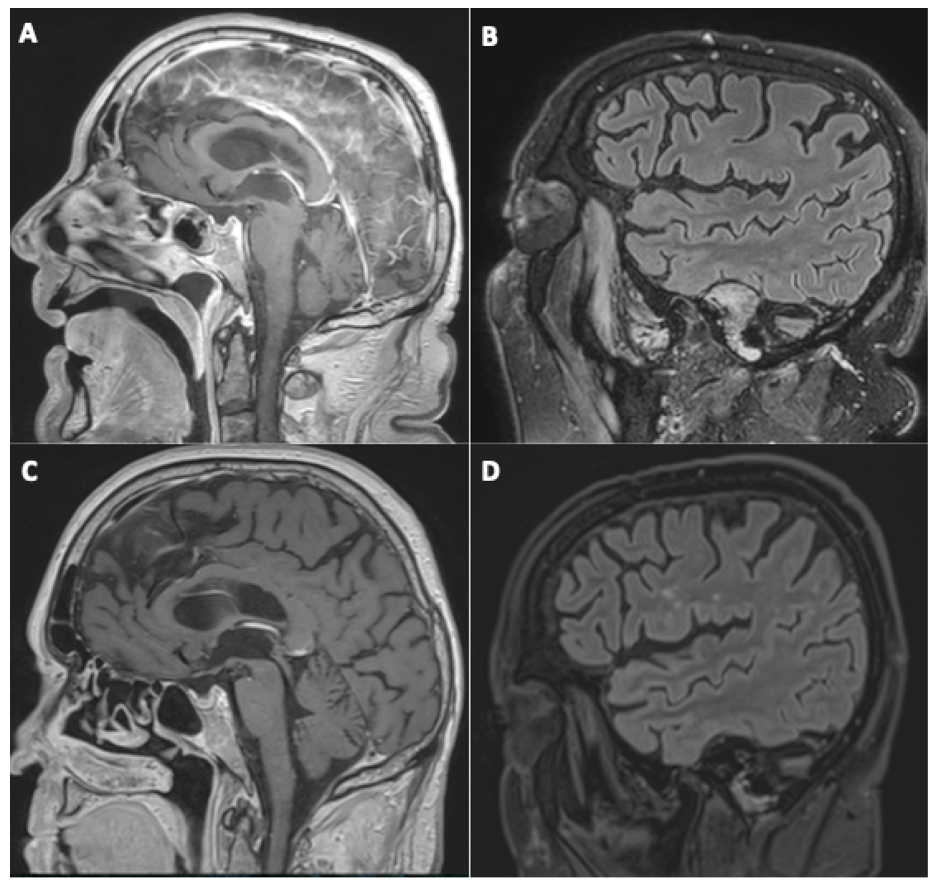 Viruses 14 00949 g002 550