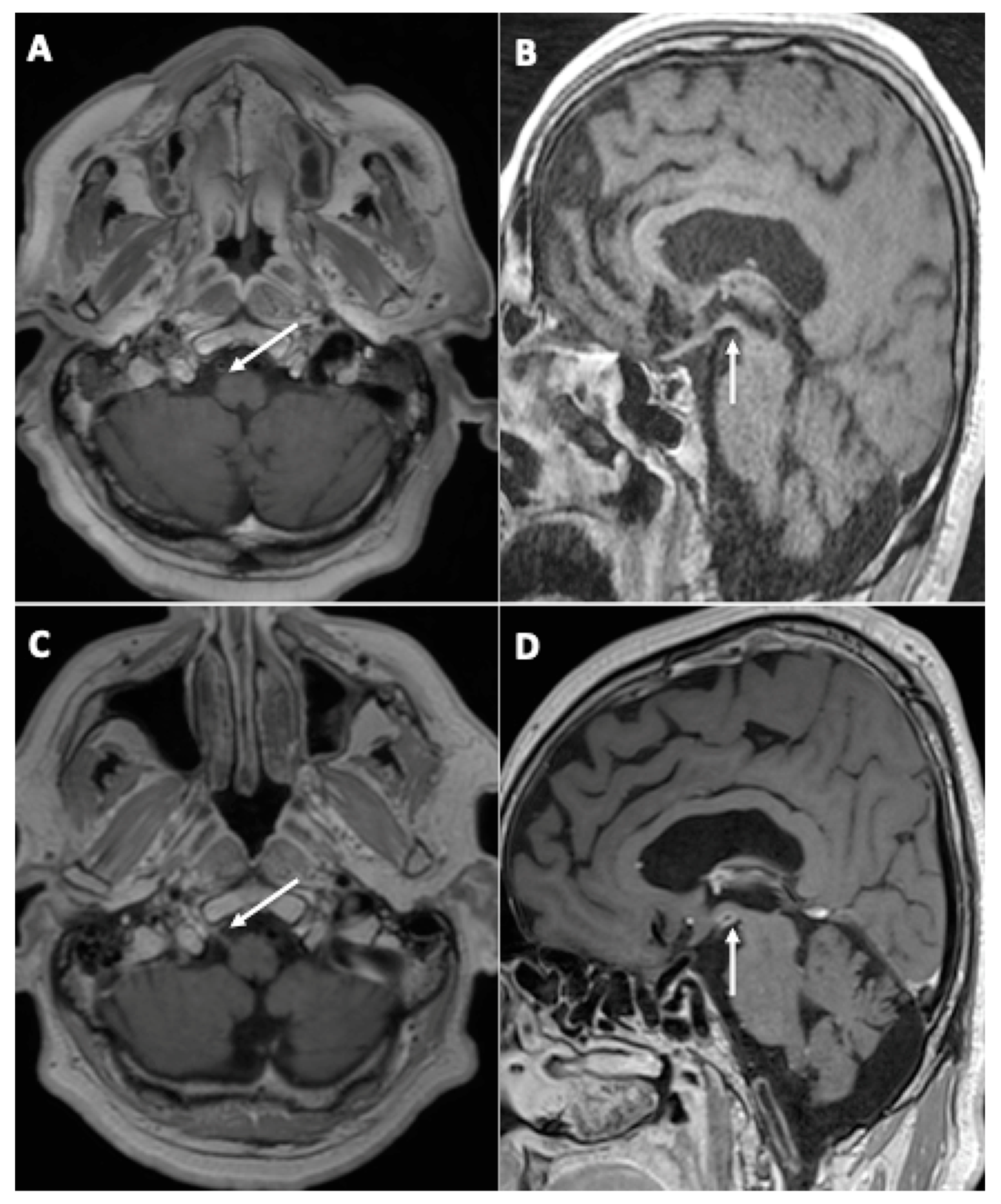 Viruses 14 00949 g003 550