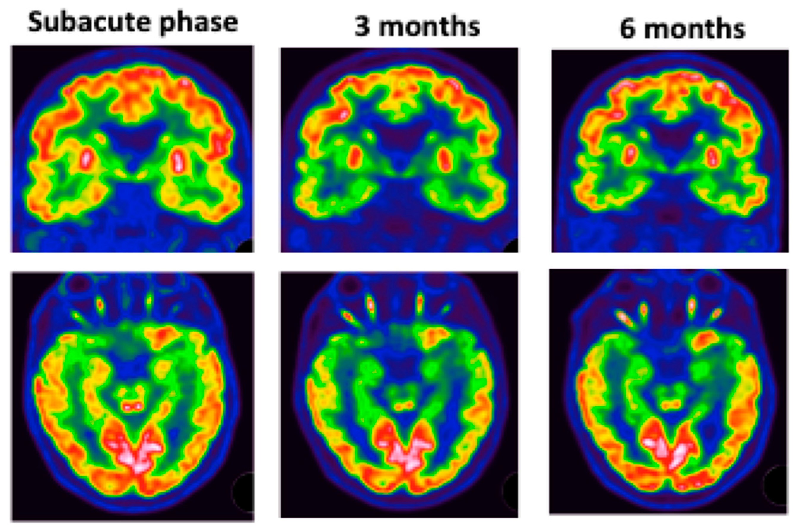 Viruses 14 00949 g005 550