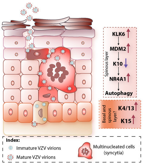 The Biology of Varicella-Zoster Virus Replication in the Skin