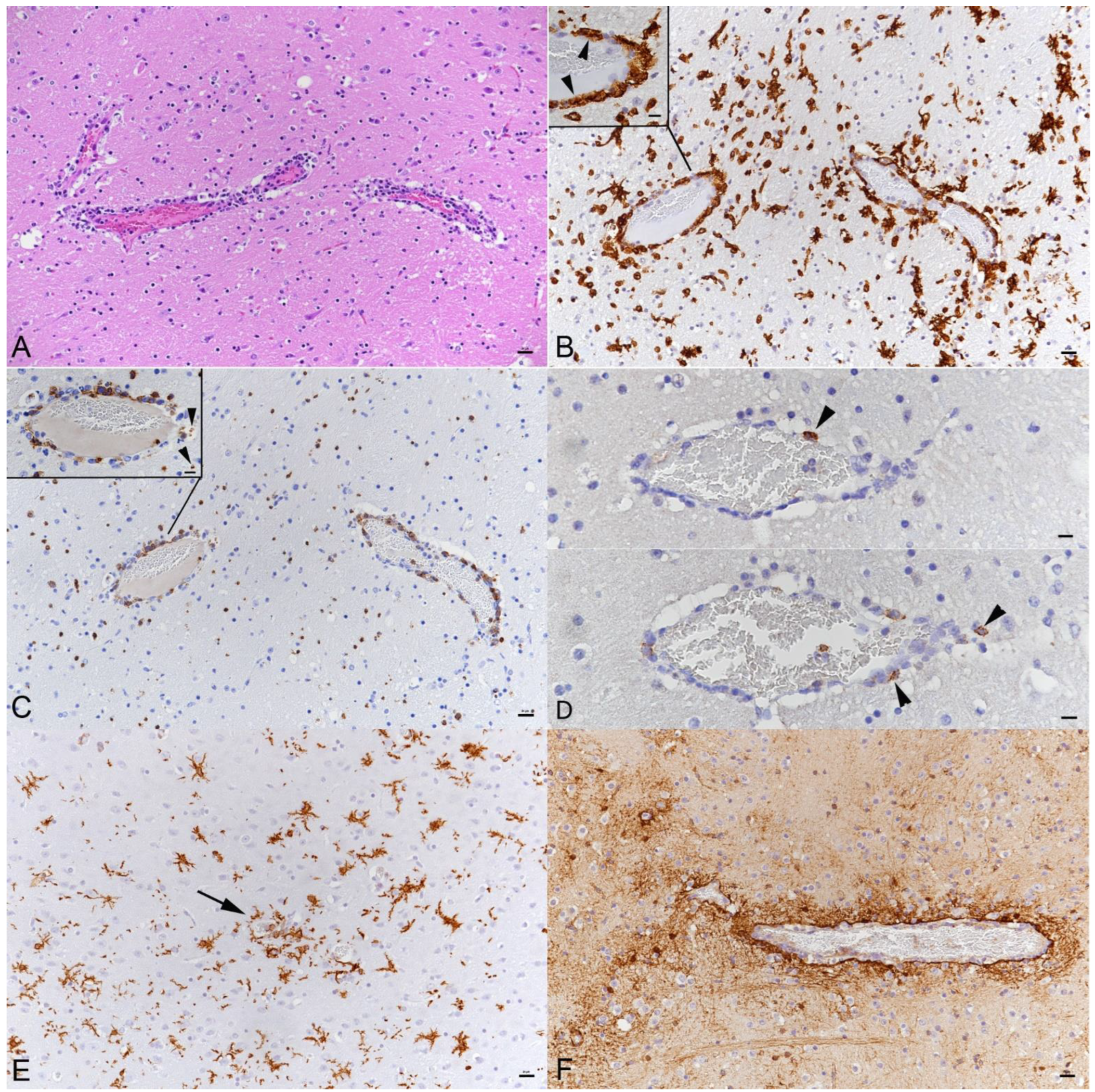 Viruses 14 01020 g004