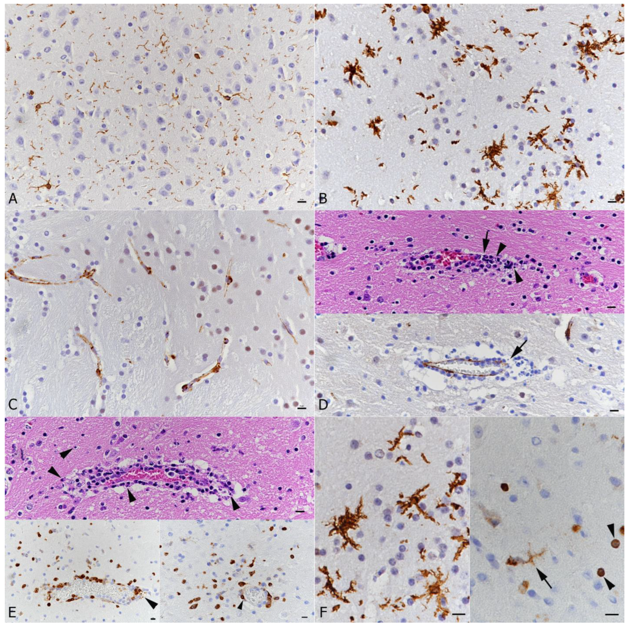 Viruses 14 01020 g005