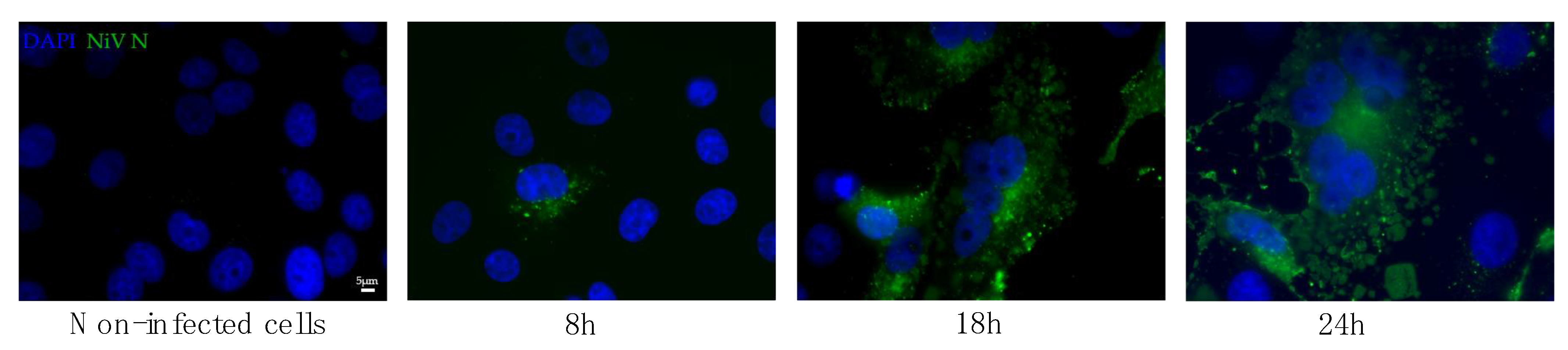 Viruses 14 01052 g002 550