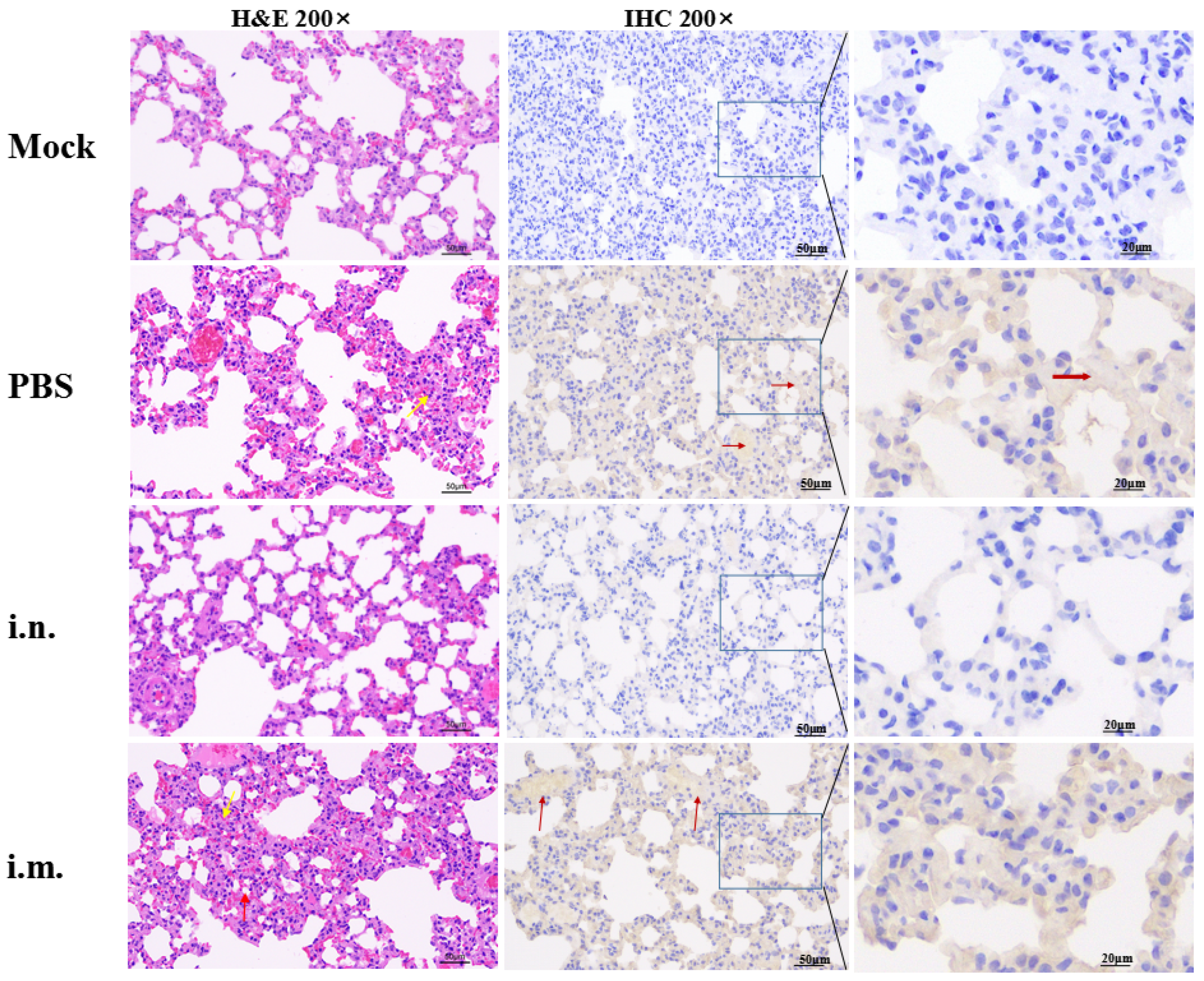 Viruses 14 01127 g005