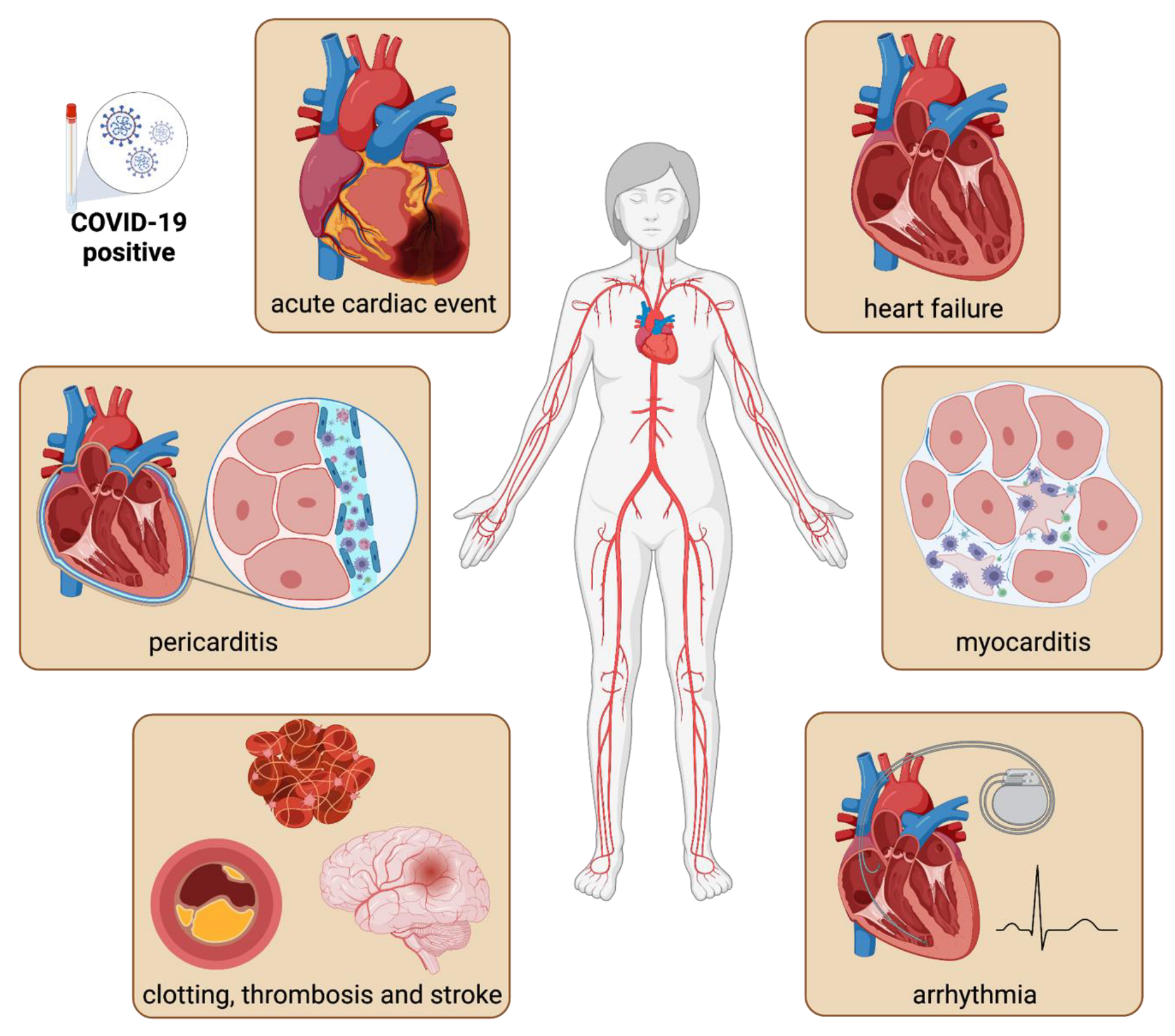 SARS-CoV-2 in humans