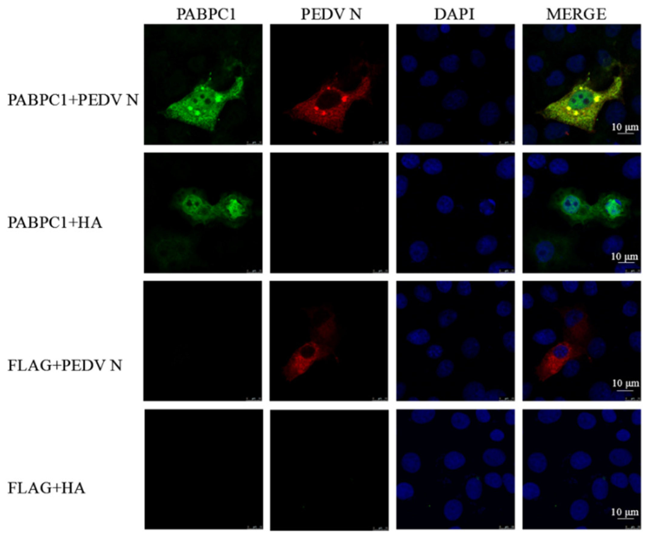 Poly(A)-Binding Protein Cytoplasmic 1 Inhibits Porcine