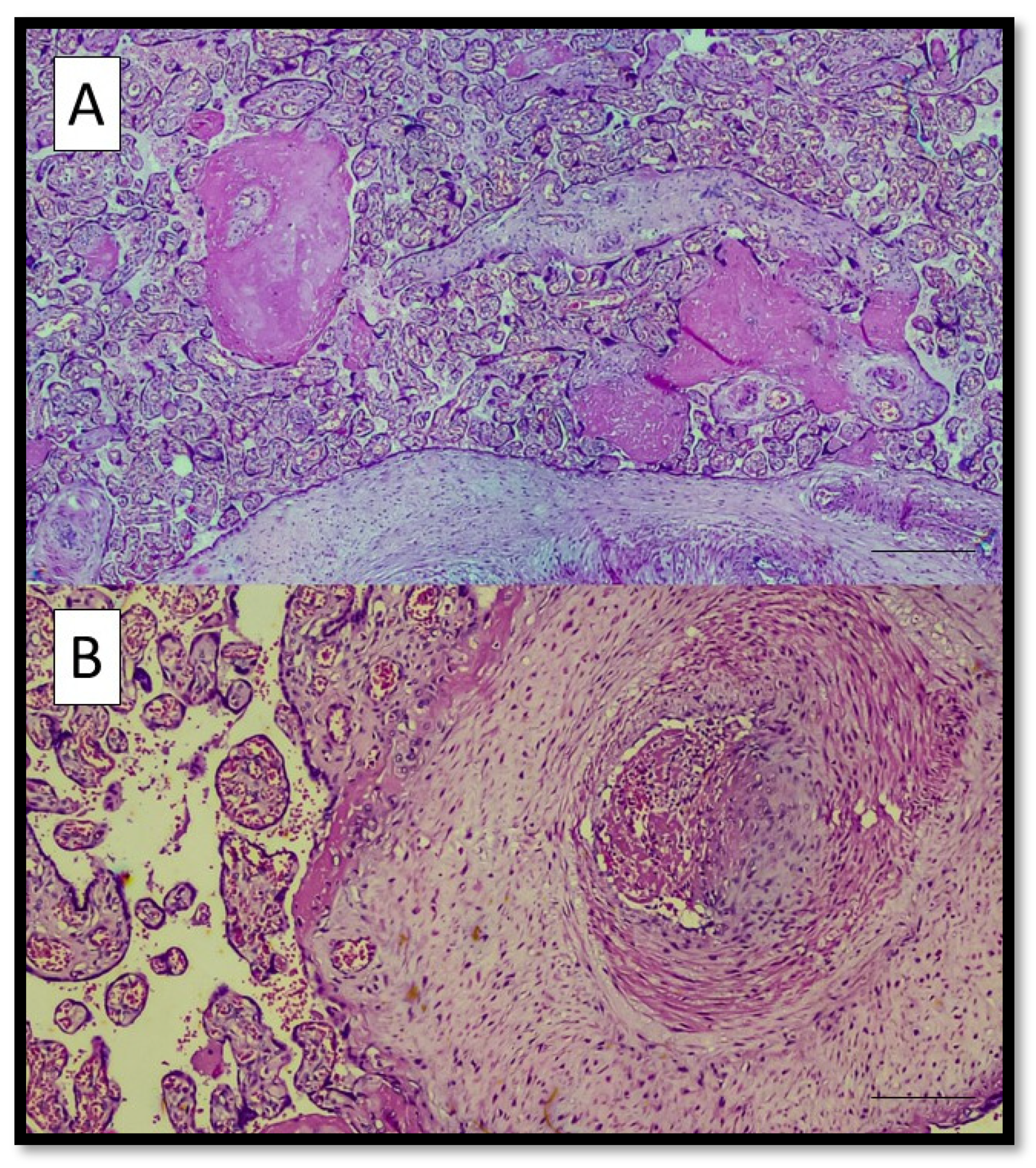 Viruses 14 01330 g0a1 550