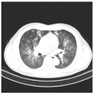 Viruses 14 01667 i003