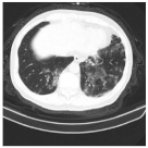 Viruses 14 01667 i004