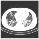 Viruses 14 01667 i006