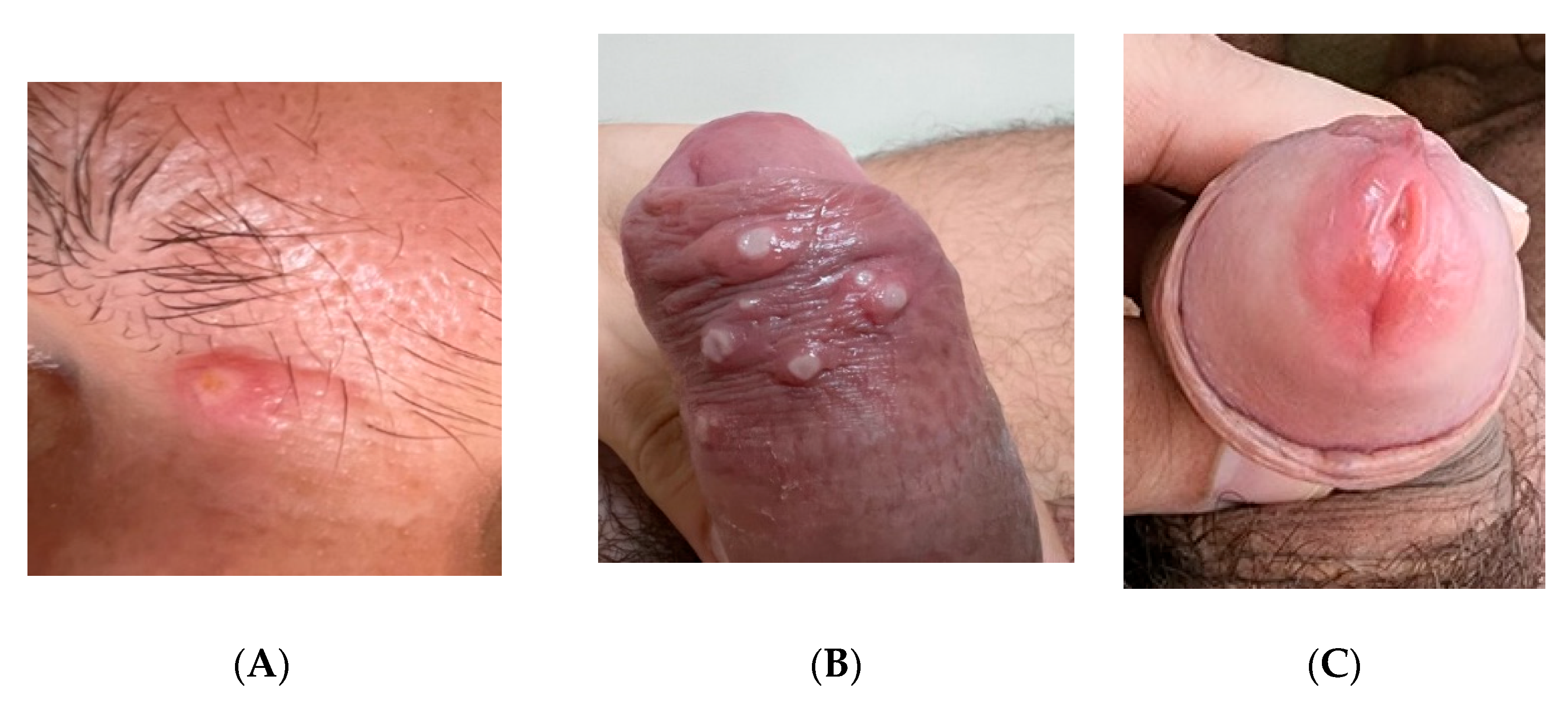 Viruses 14 01841 g001