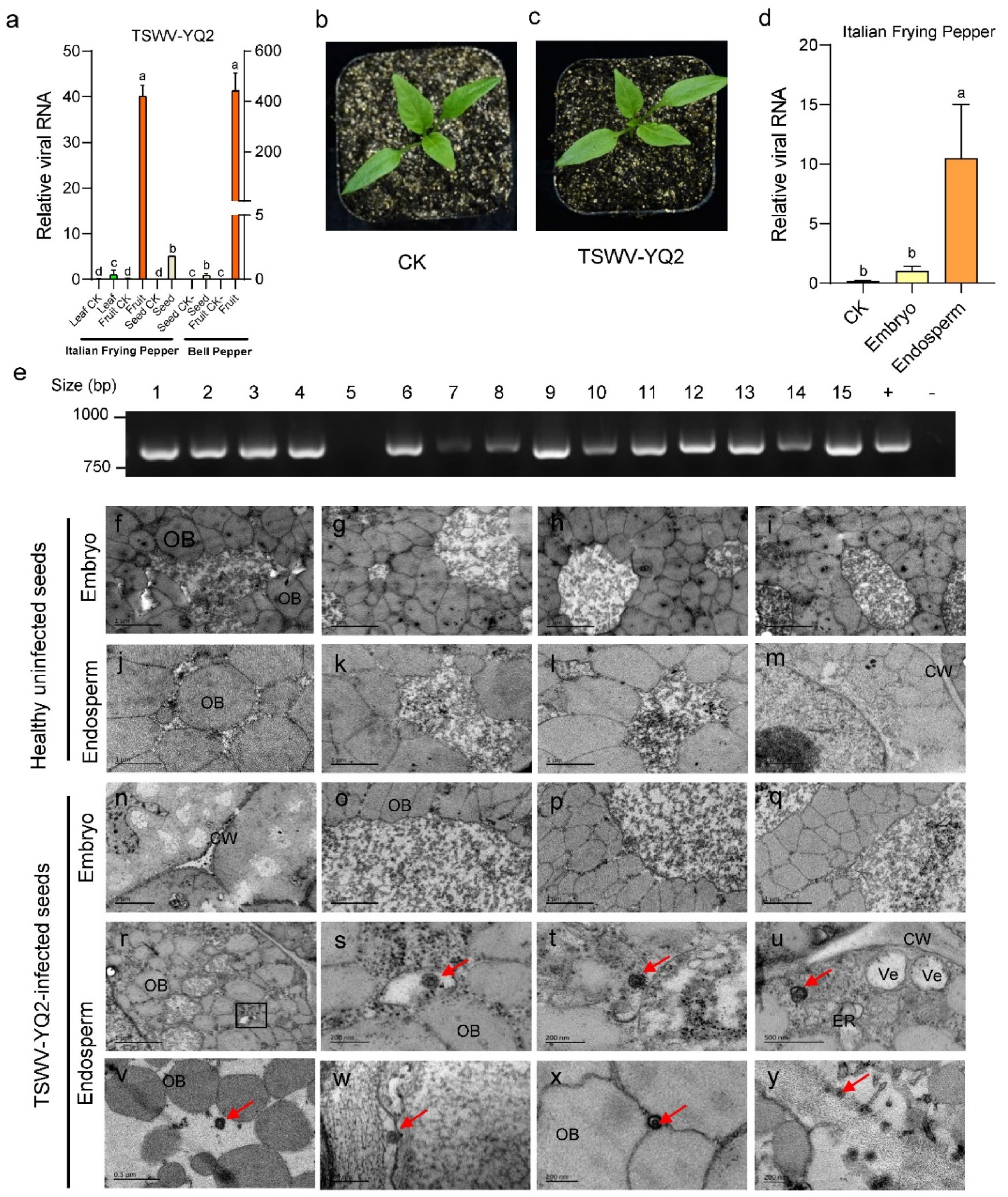 Viruses 14 01873 g002 550