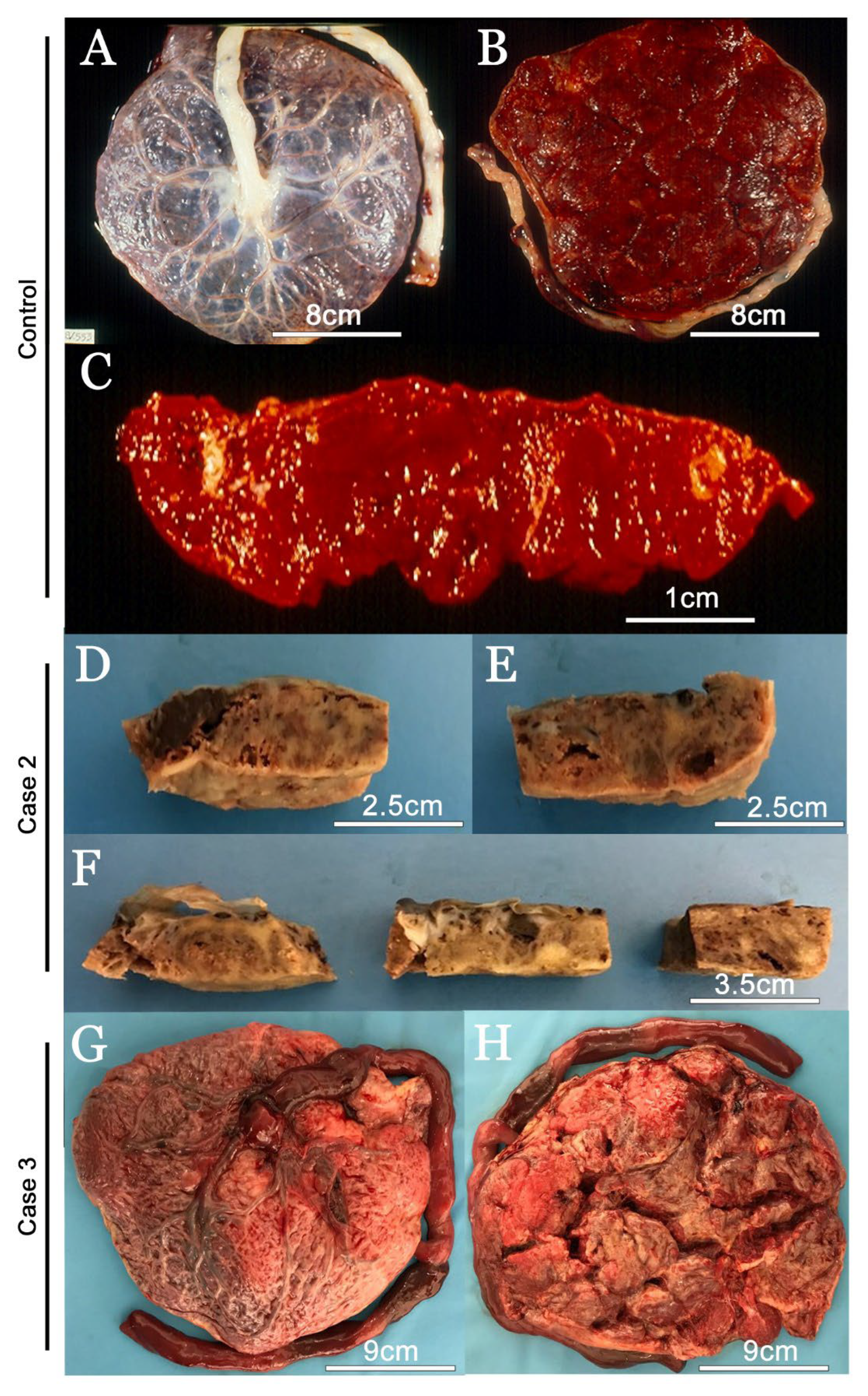 Viruses 14 01885 g001
