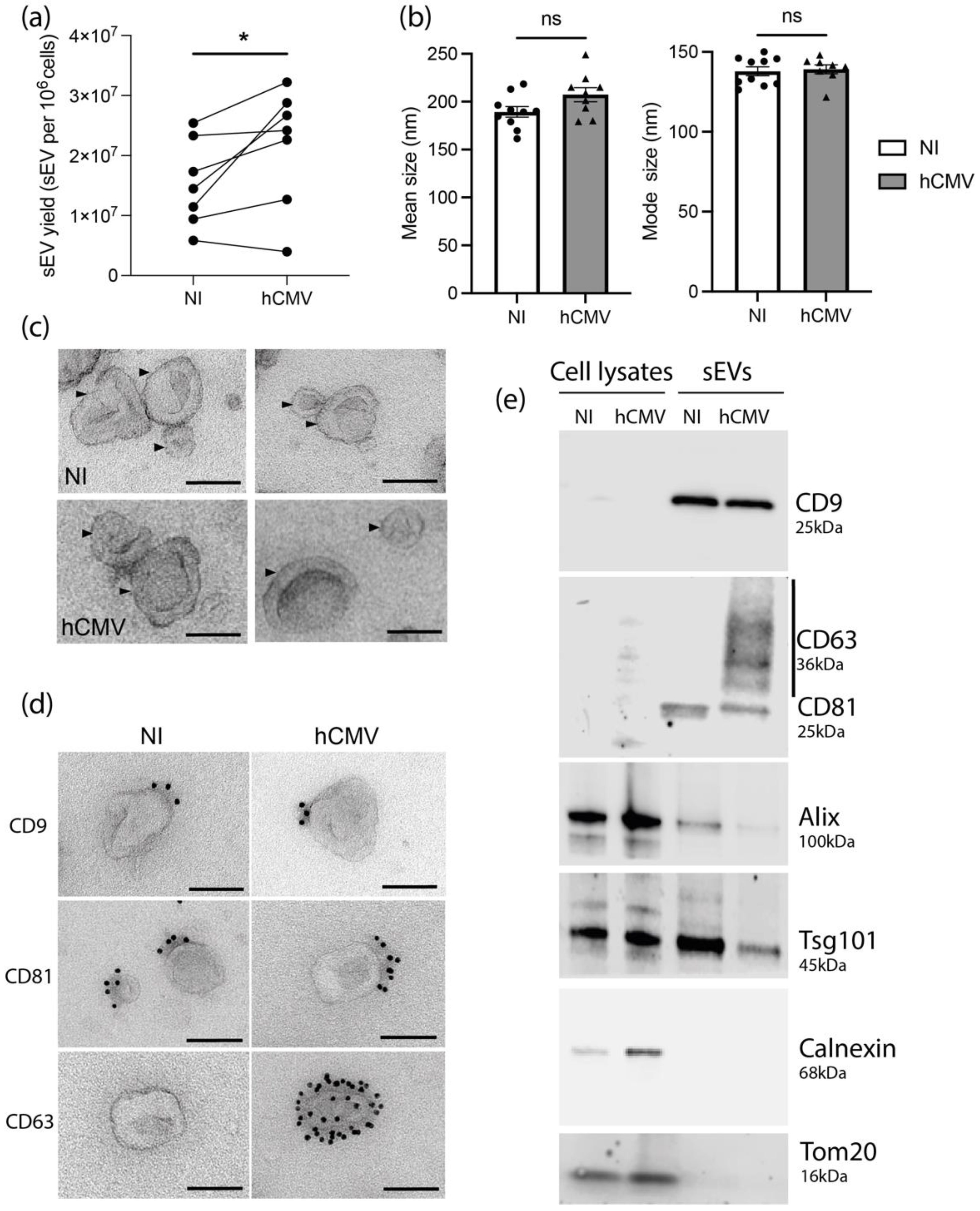Viruses Free Full Text Human Cytomegalovirus Modifies Placental Small Extracellular Vesicle Composition To Enhance Infection Of Fetal Neural Cells In Vitro Html